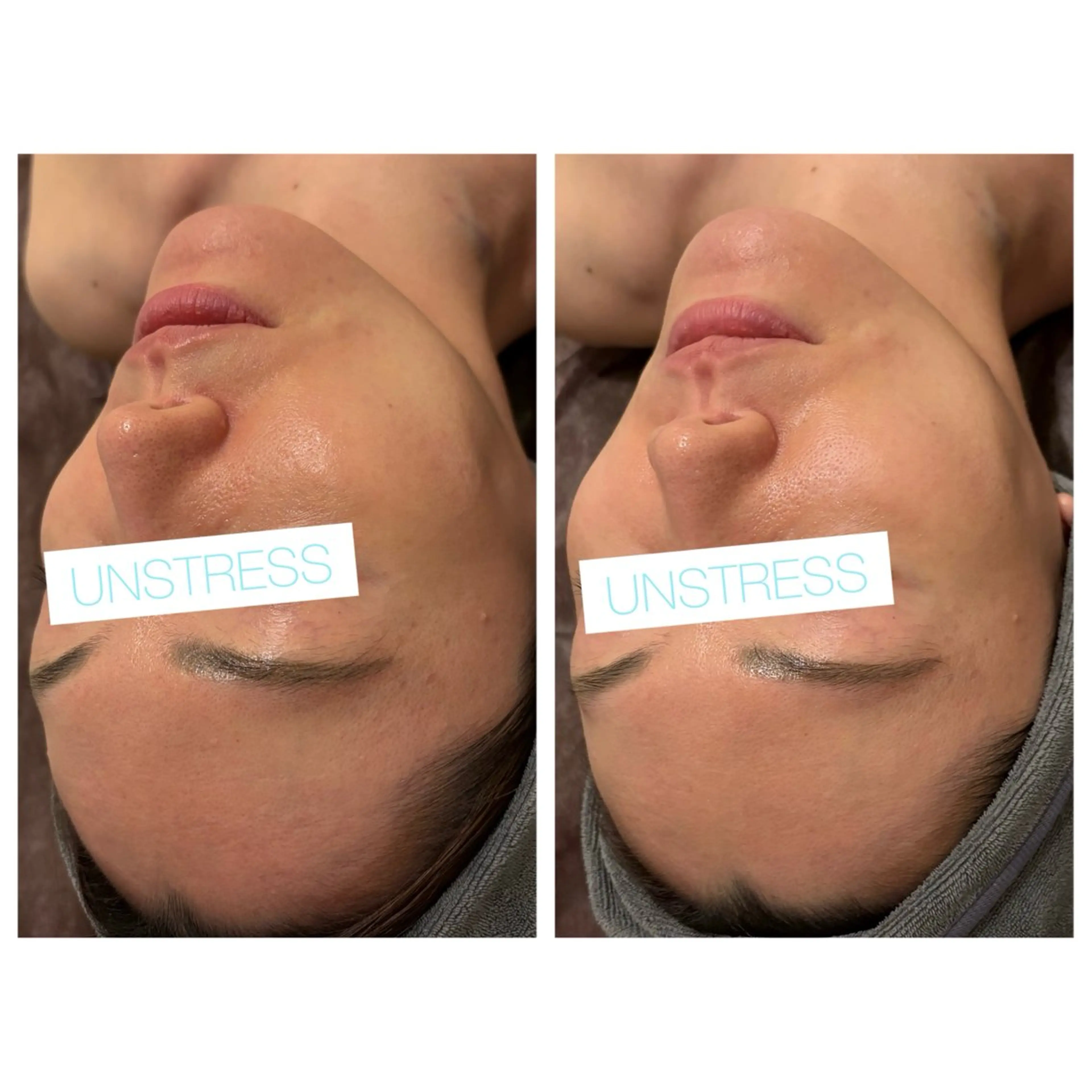 エステ ☆痩身/小顔☆ 結果出します☆のエステ・リラクイメージ