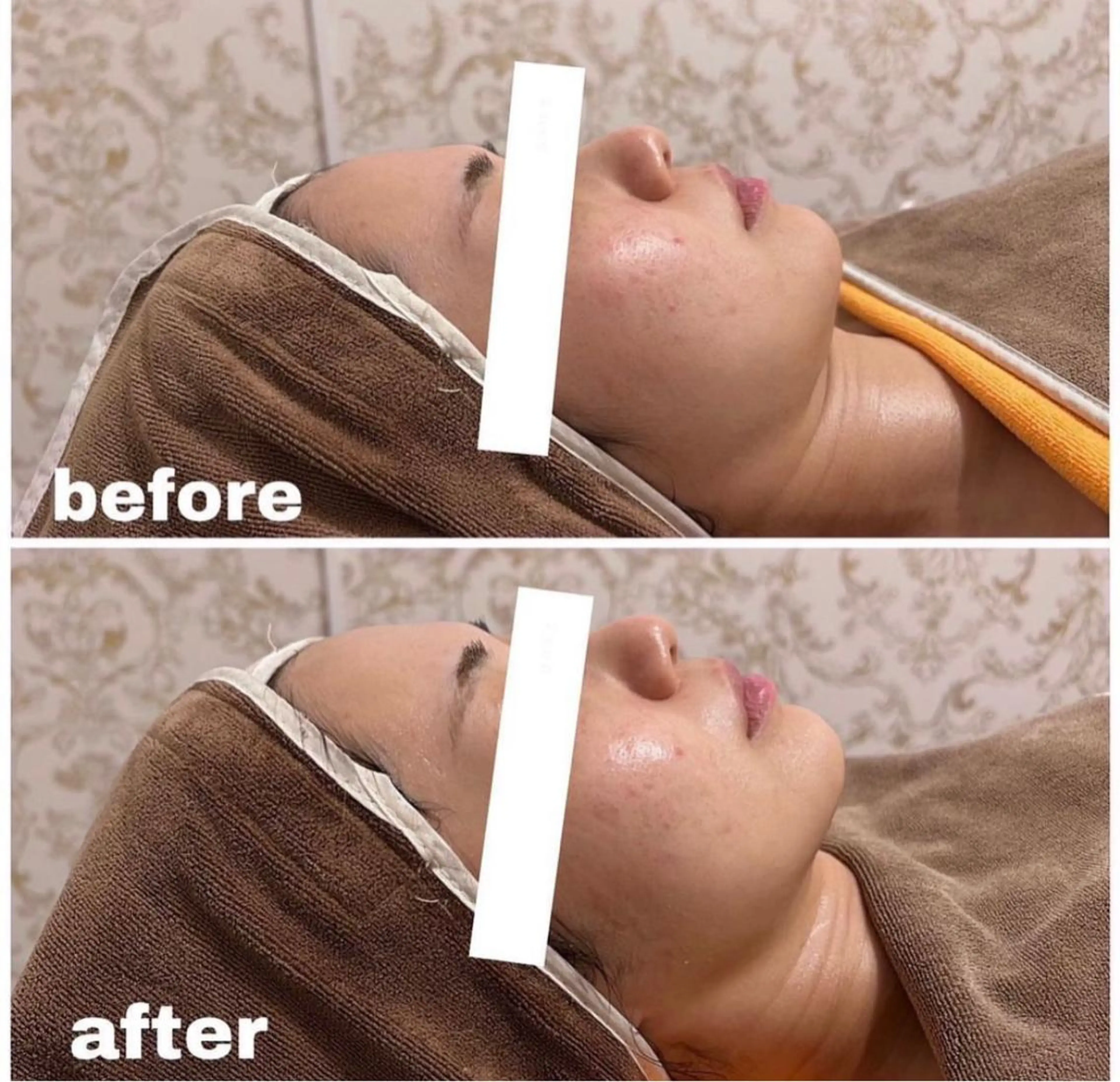 西区九条エステ MITUREIサロンのエステ・リラクイメージ