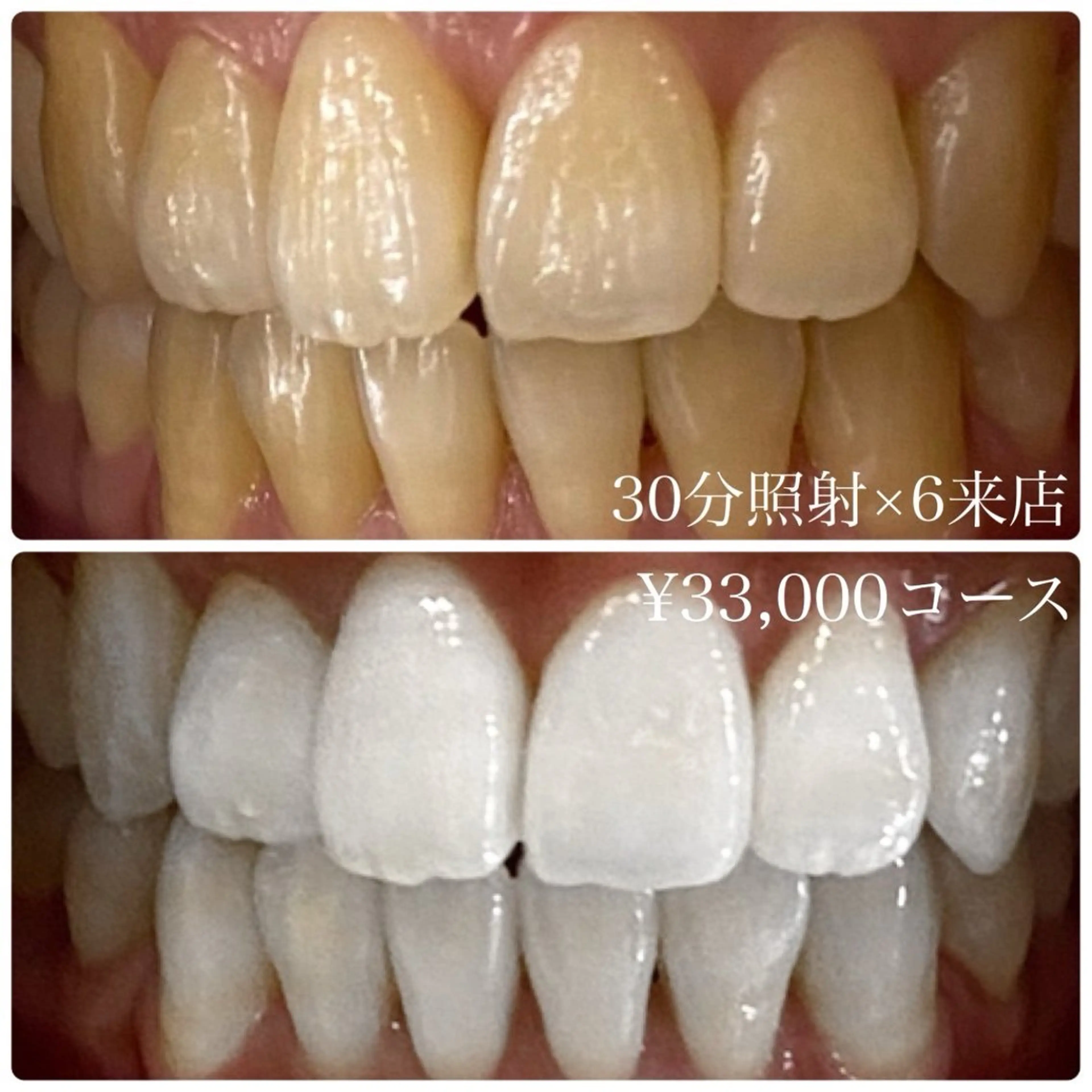 その他 PLATINUM Beauty 横浜店所属・ホワイトニングルーム 横浜店のその他イメージ