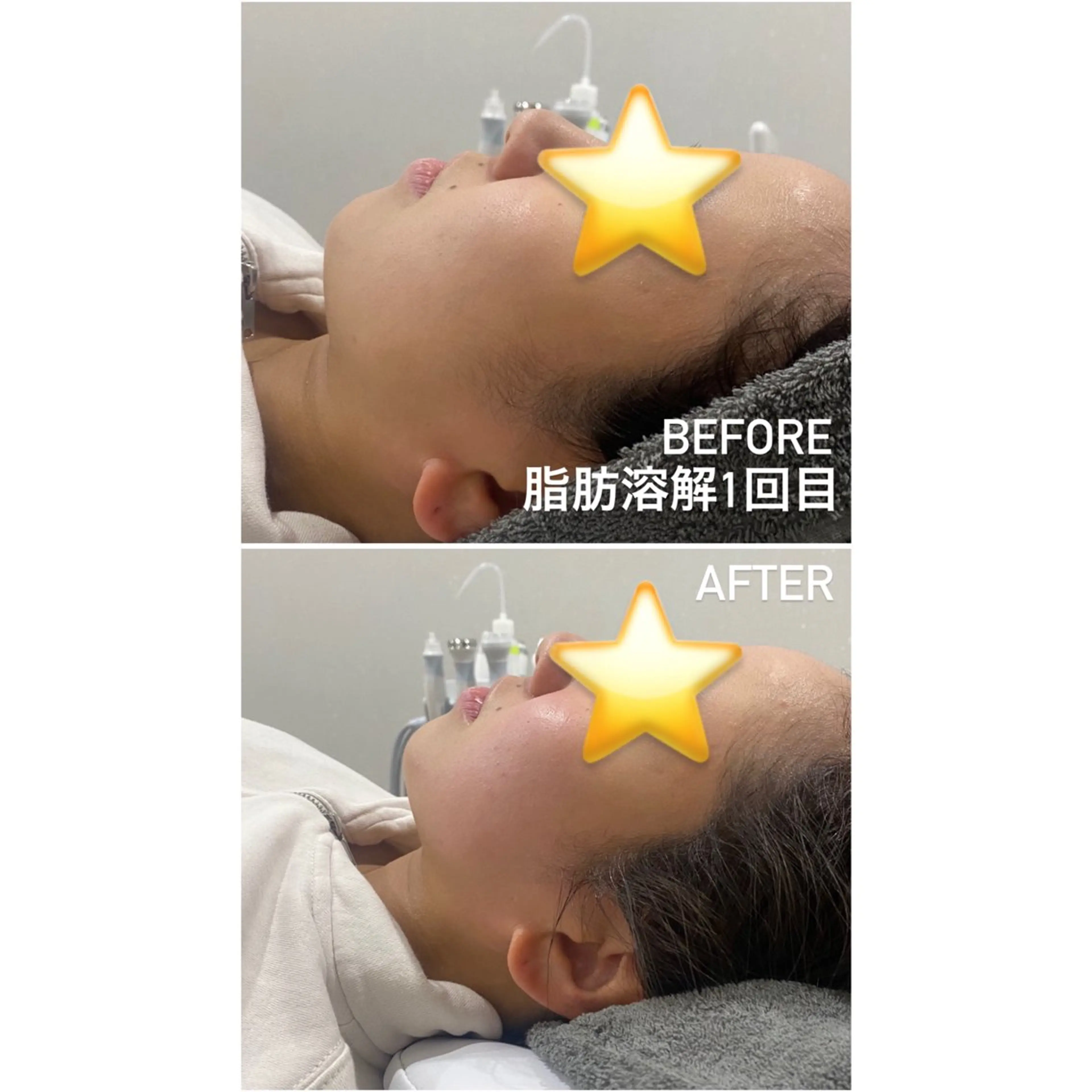 エステ 毛穴洗浄・痩身・脱毛 /アルカンジュのエステ・リラクイメージ