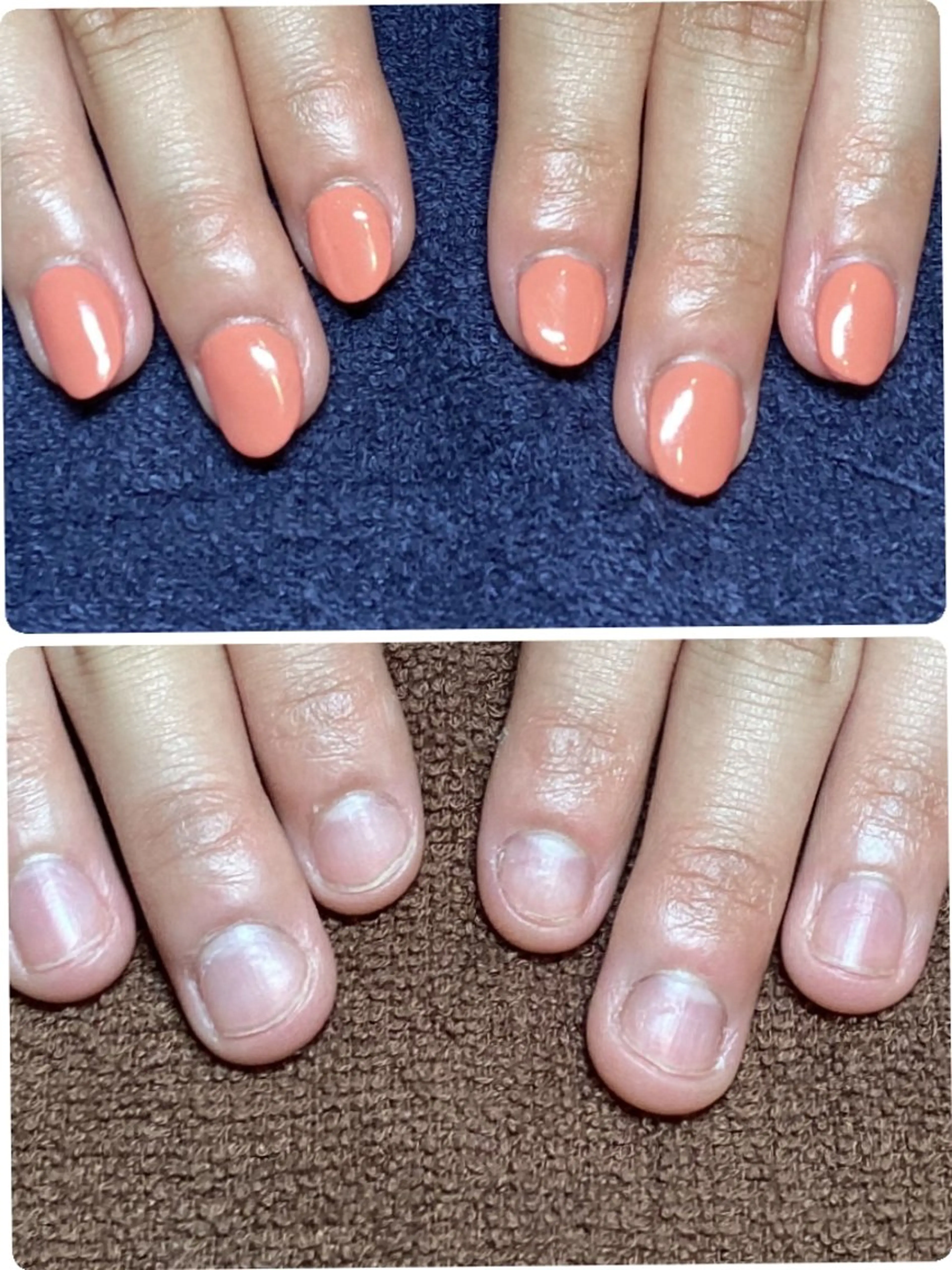 ネイル ハンドネイル ハンドケア 深爪矯正/爪育成ケア manie nailのネイルデザイン