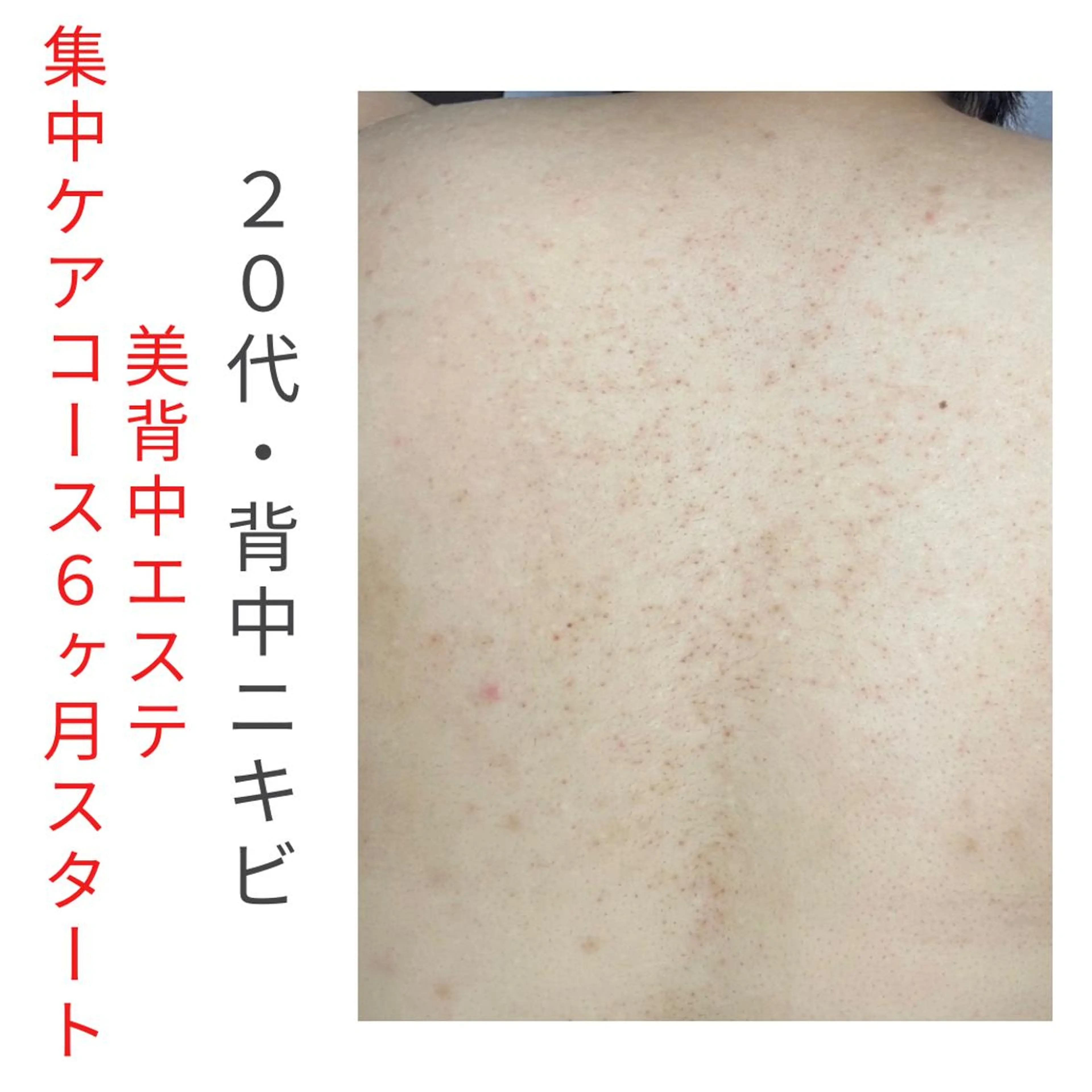 ベラージュ【美背中・ 美尻・フェイシャル】のエステ・リラクイメージ