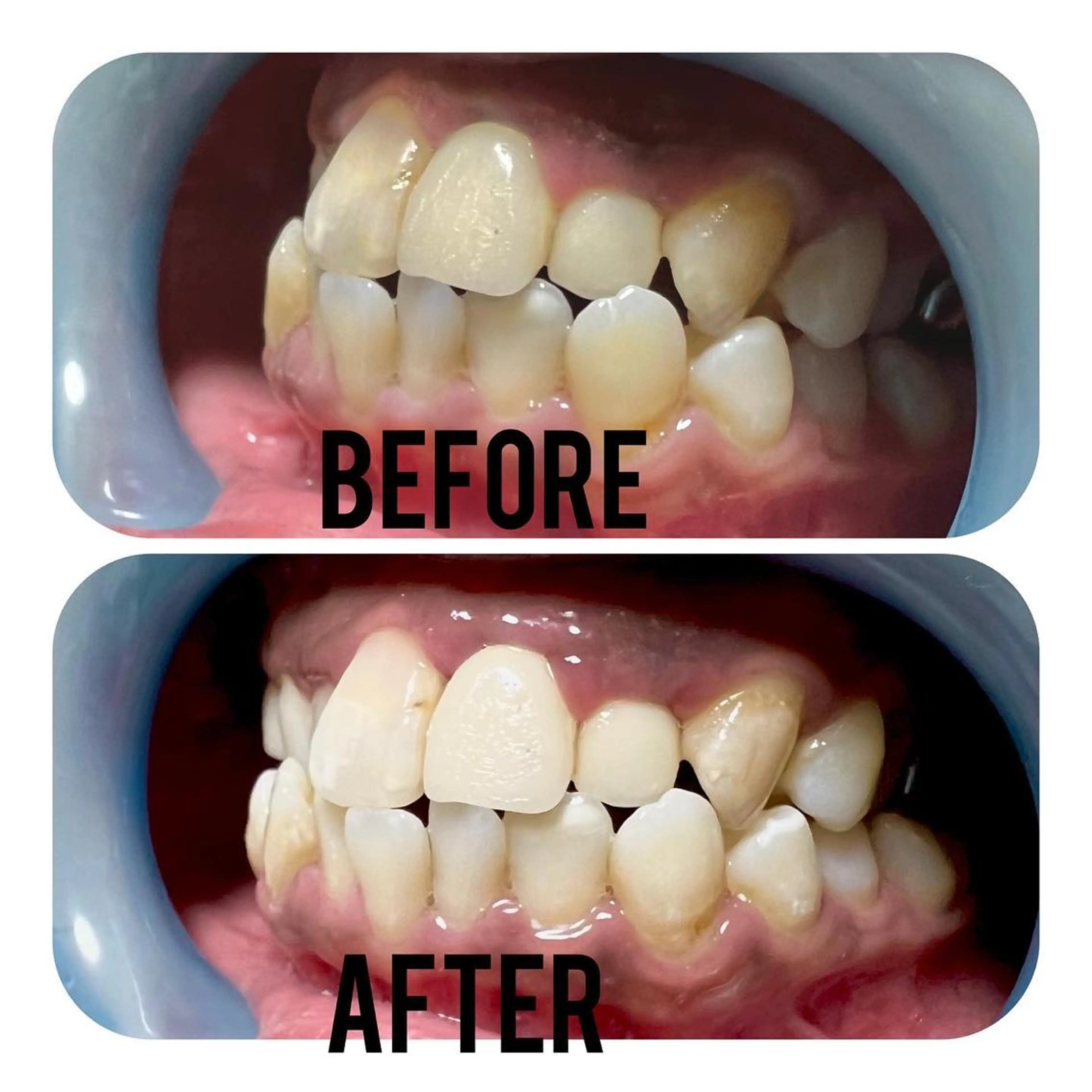 その他 two nailのネイルデザイン