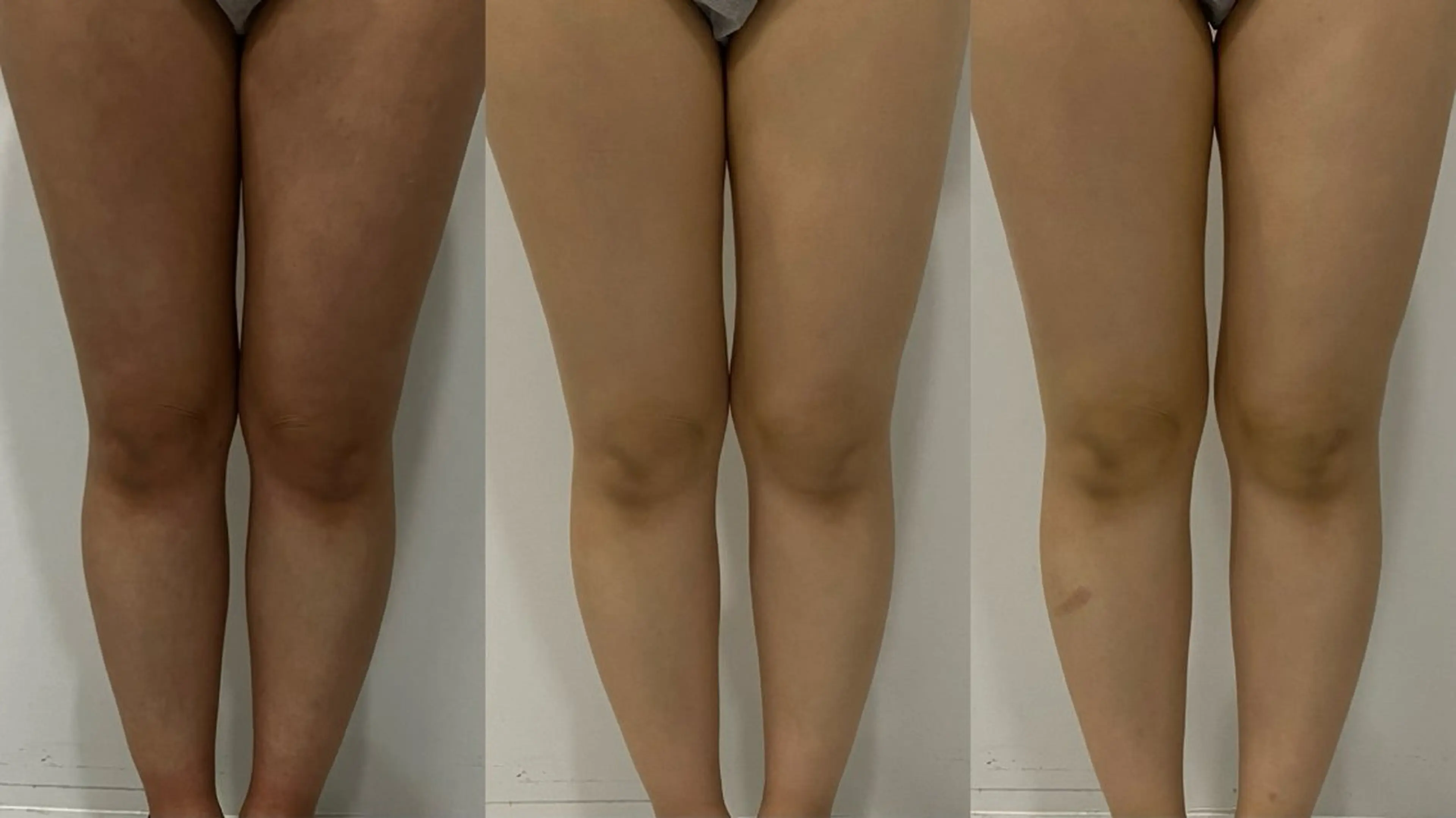 Clear Canvasのエステ・リラクイメージ