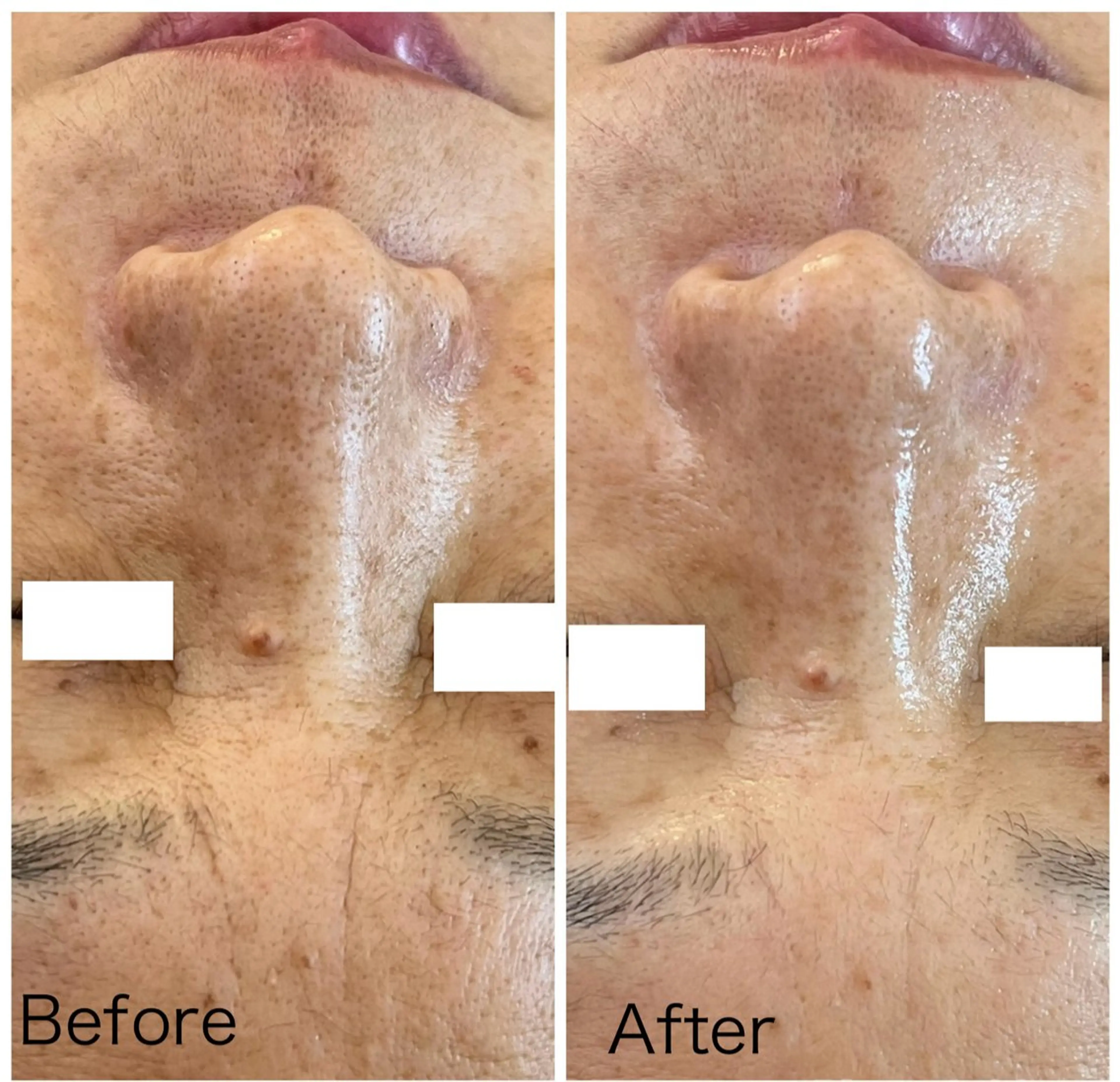 エステ エイジングケア専門 Ponolaのエステ・リラクイメージ