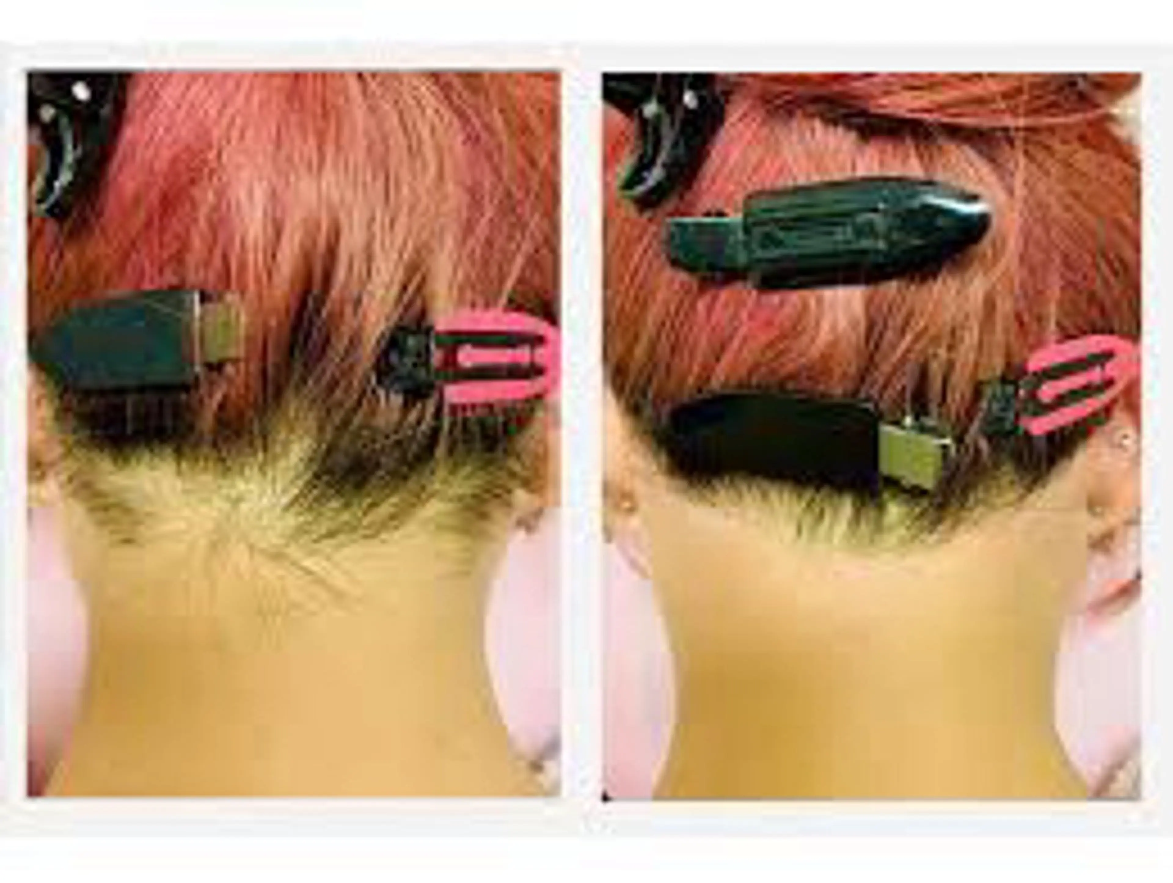 脱毛 BRILLIANCE ブリリアンスのエステ・リラクイメージ