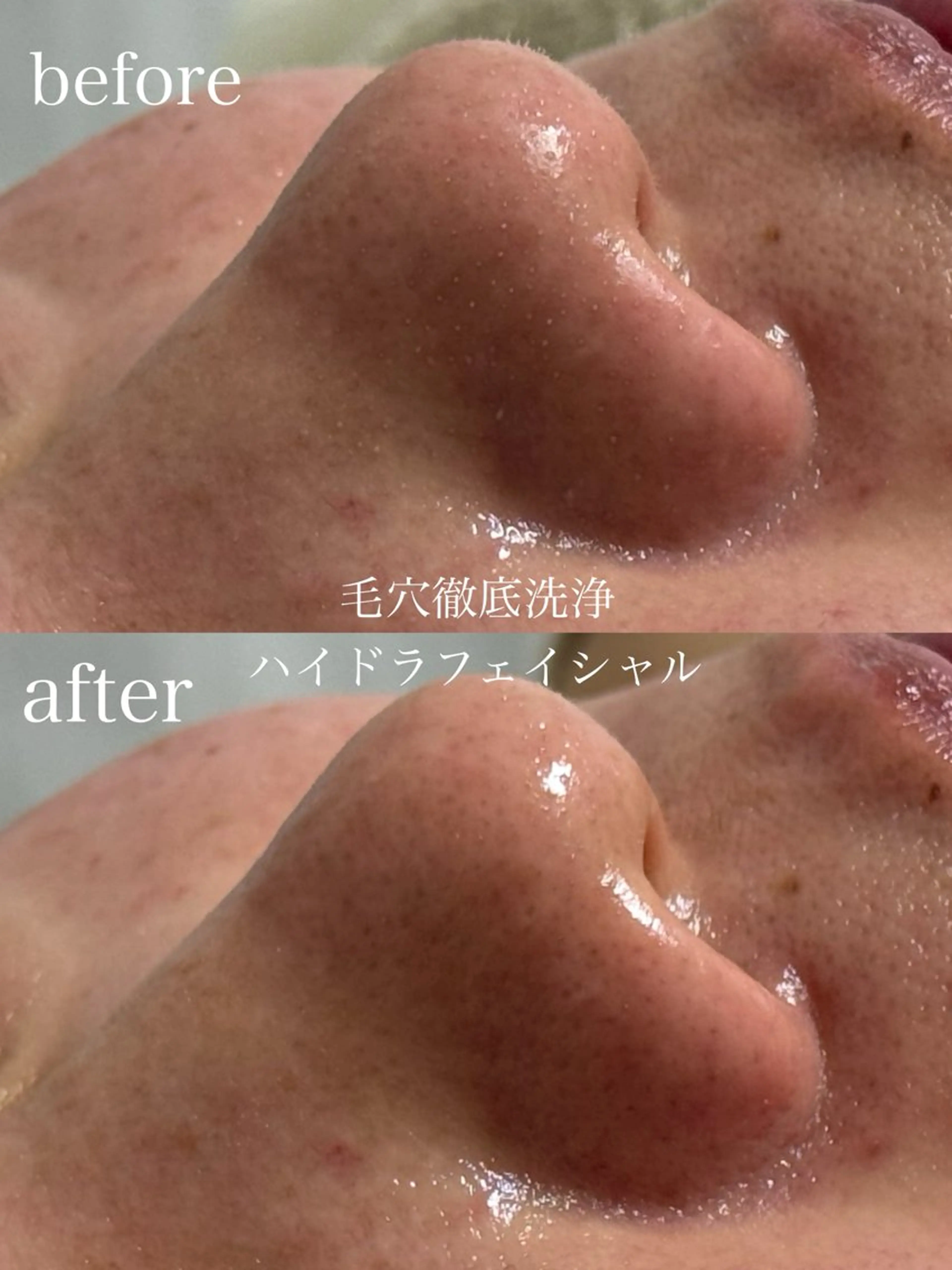 エステ フェイシャルサロン CHIARA鈴木のエステ・リラクイメージ