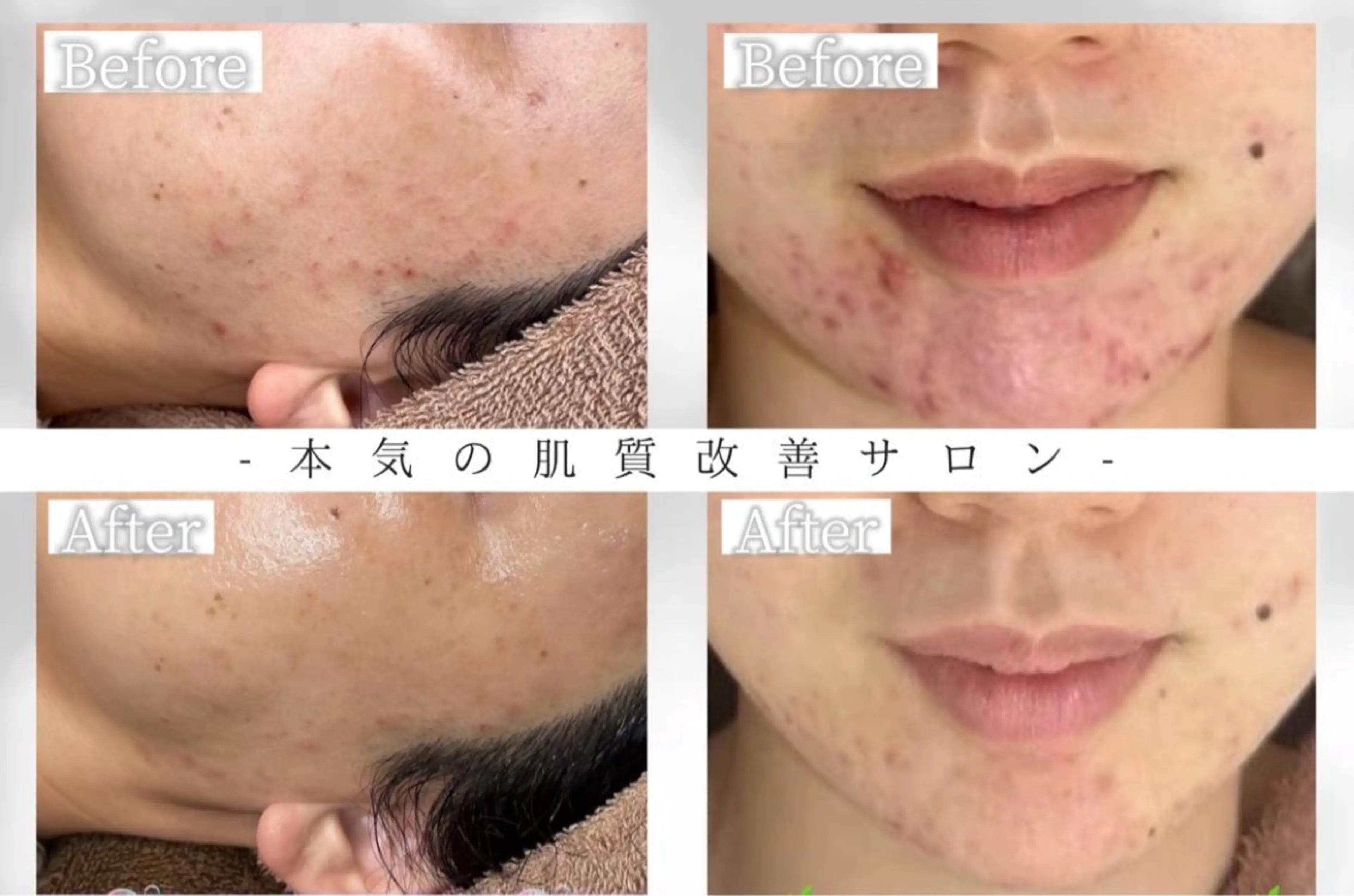 エステ White Aqua京橋店所属・WHITE AQUAのエステ・リラクイメージ