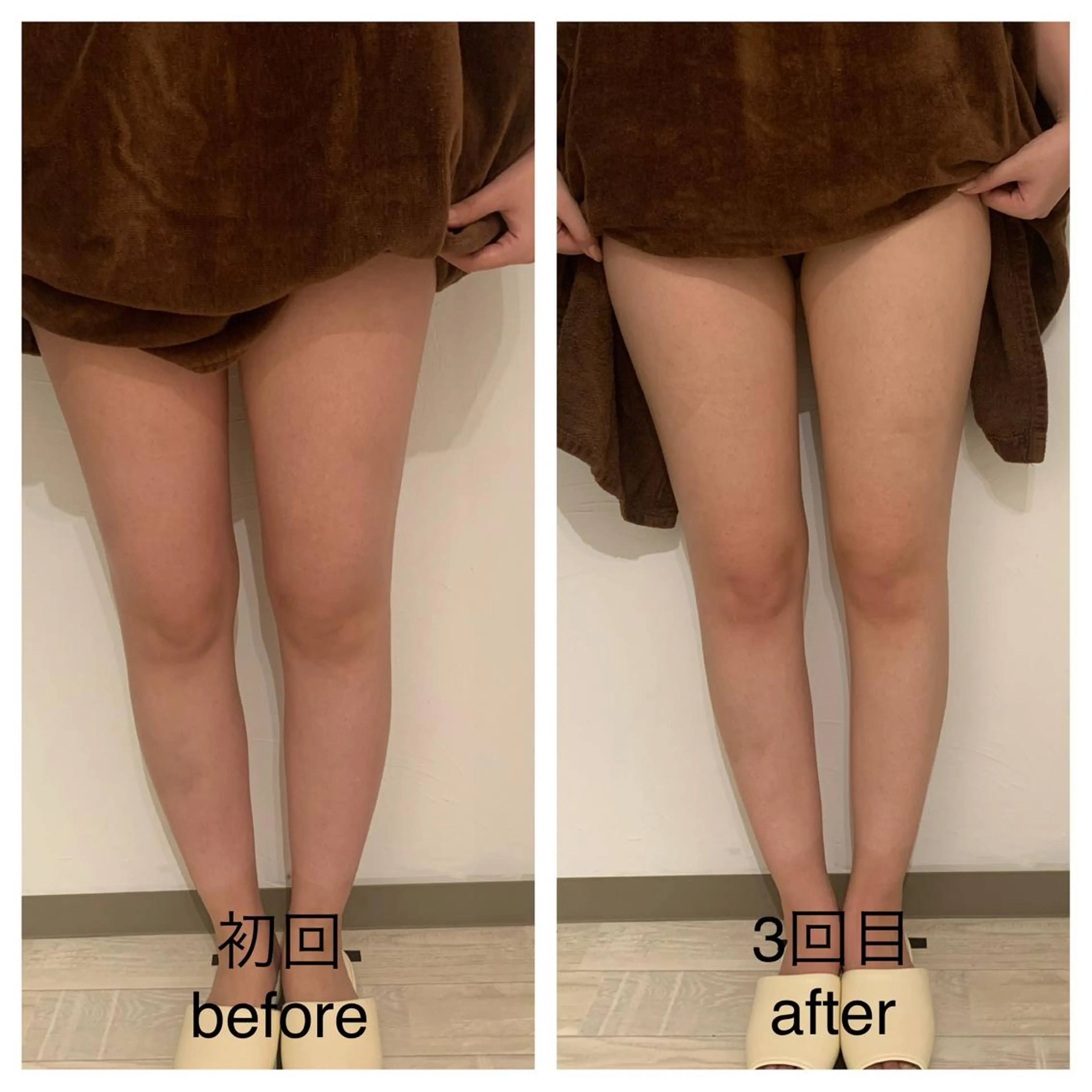 リンパマッサージ&ピラティスmimoza所属・リンパマッサージ mimozaのエステ・リラクイメージ