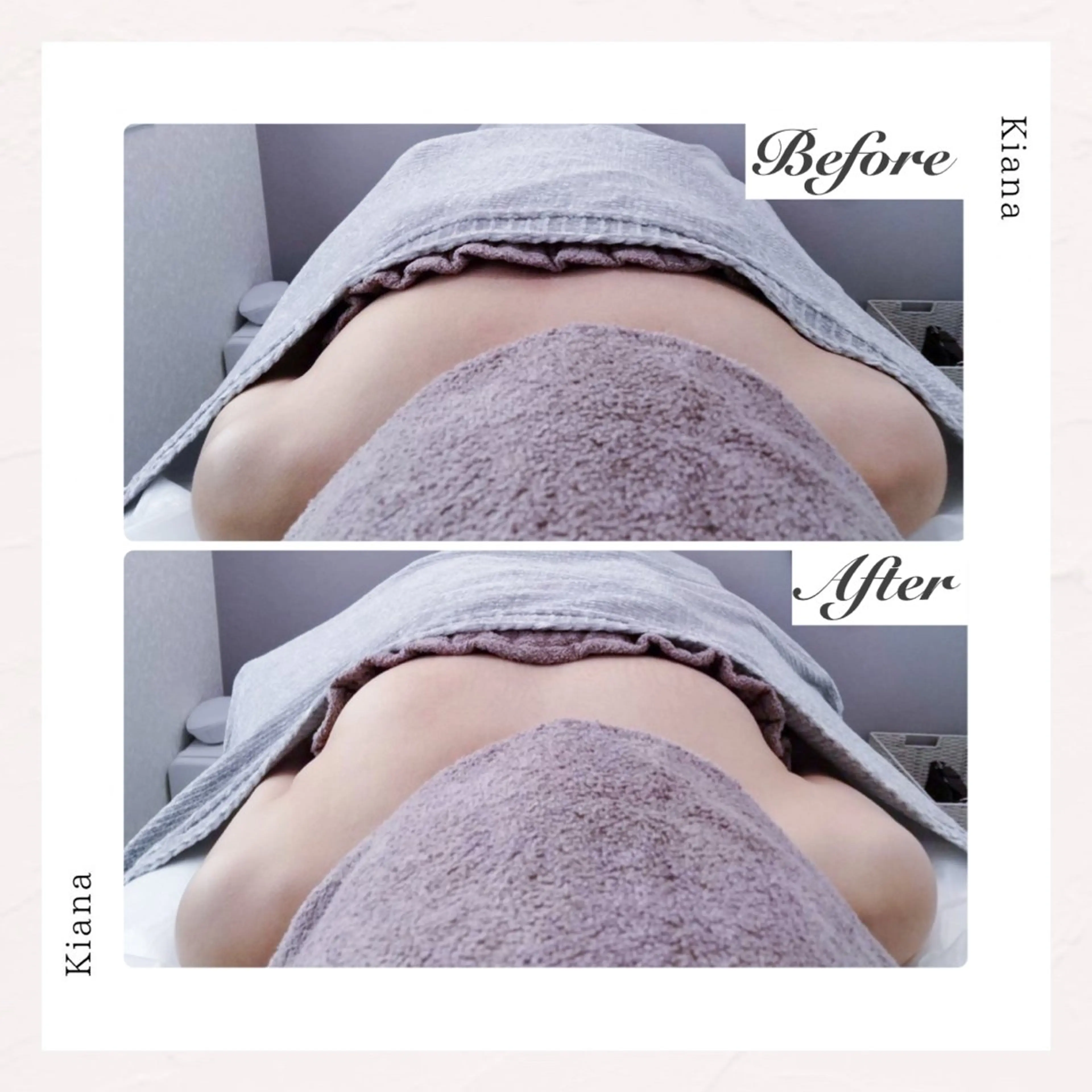 バスト専門Kiana 風のエステ・リラクイメージ