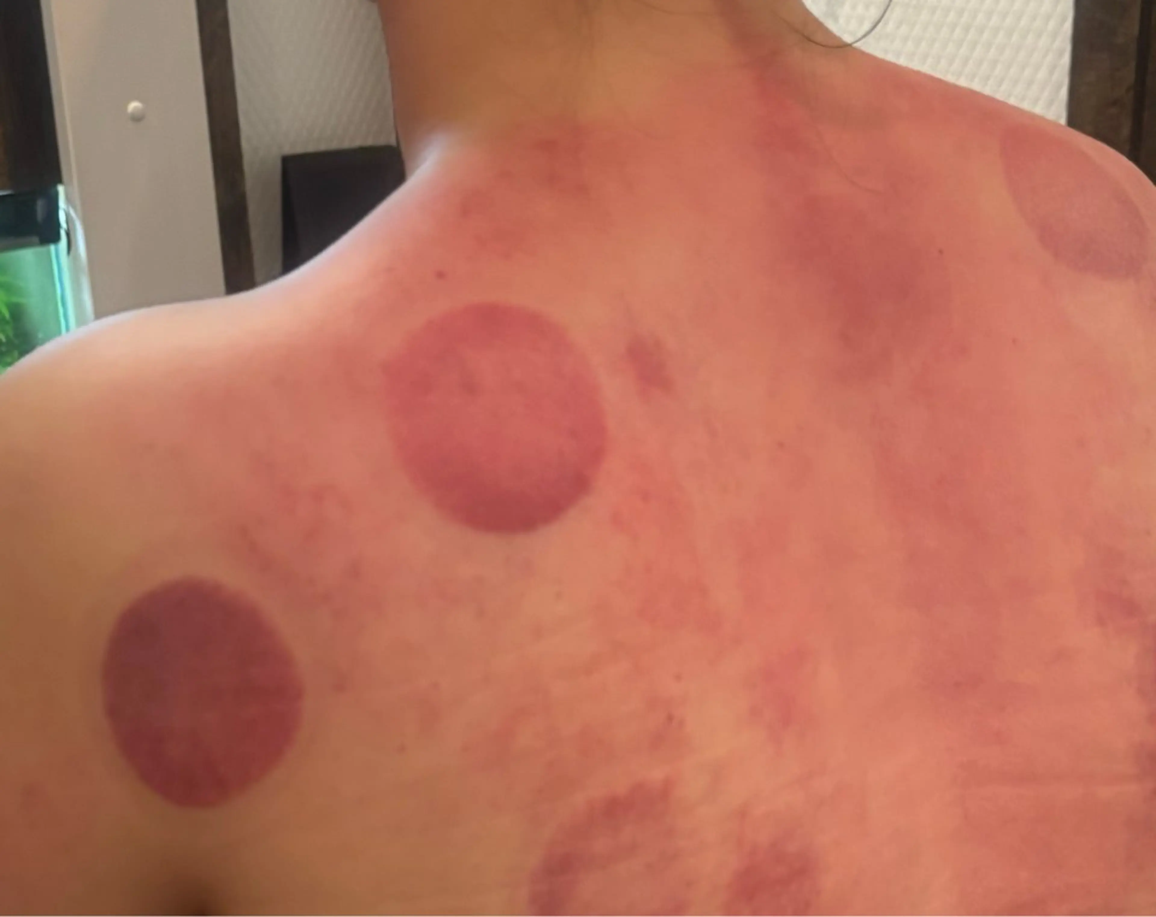 リラク かっさ（刮痧）専門店 心氣院のその他イメージ