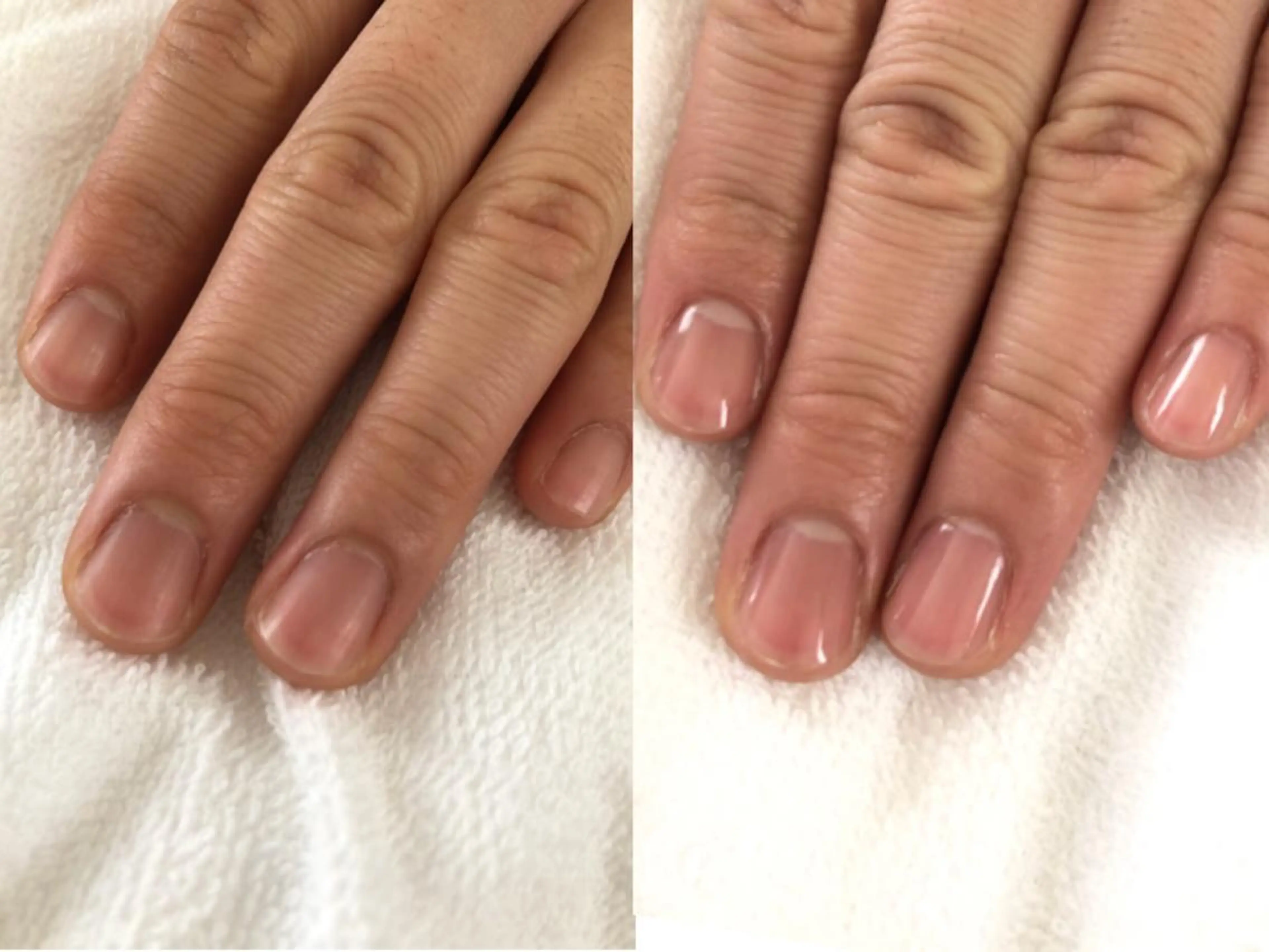 ネイル Allure小山店 高橋陽香のネイルデザイン