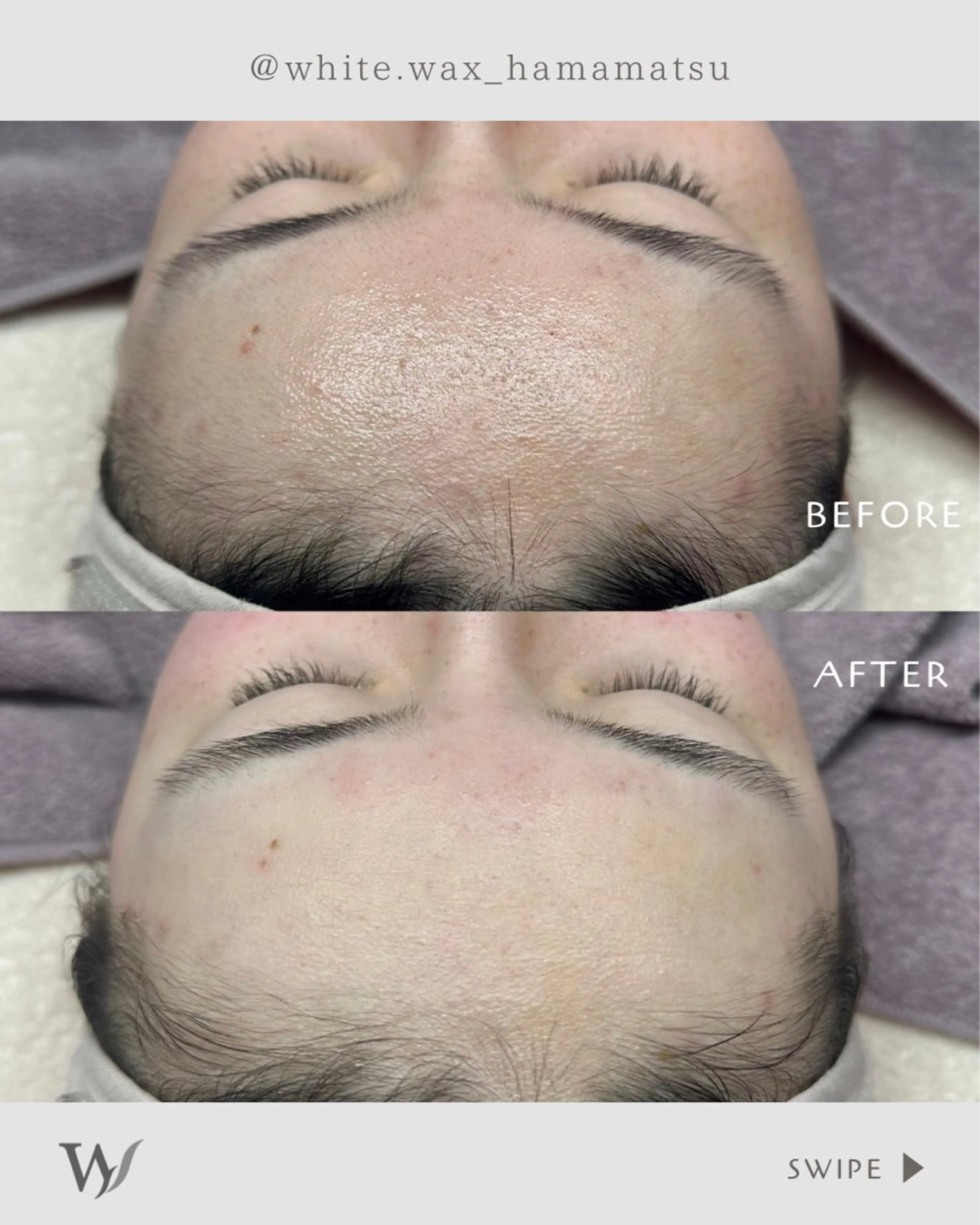 脱毛 フェイシャルワックス KANAKOのエステ・リラクイメージ