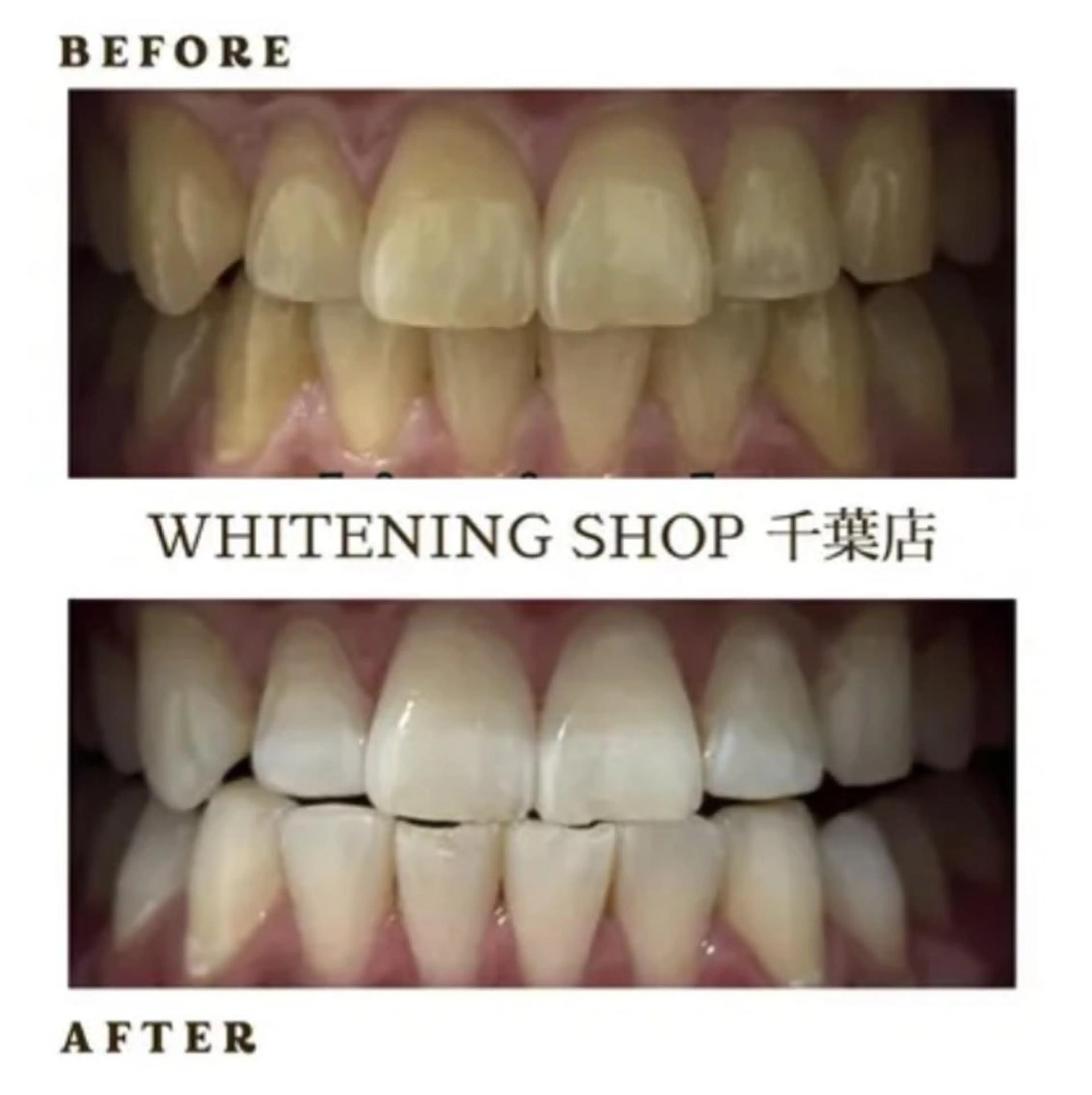 メンズ その他 ホワイトニング ショップ千葉店のその他イメージ