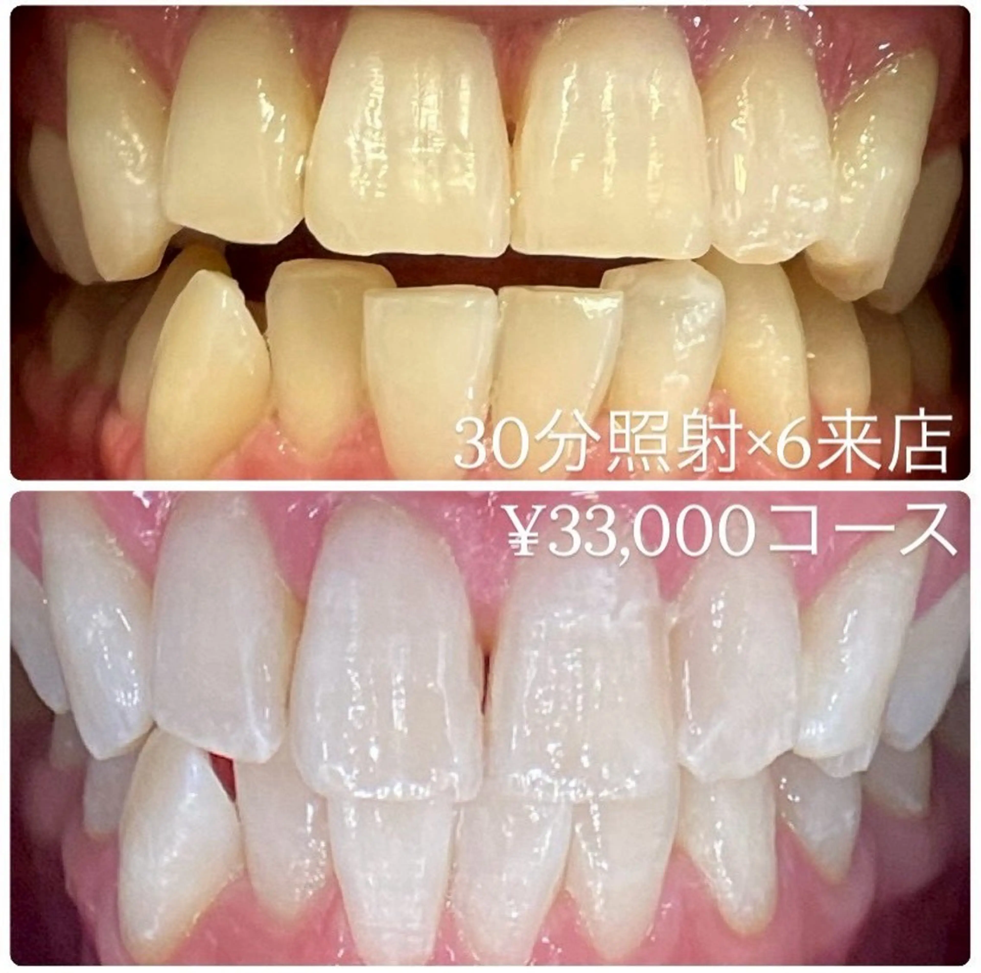 メンズ その他 ホワイトニングルーム　川崎店所属・ホワイトニング ルーム　川崎店のその他イメージ