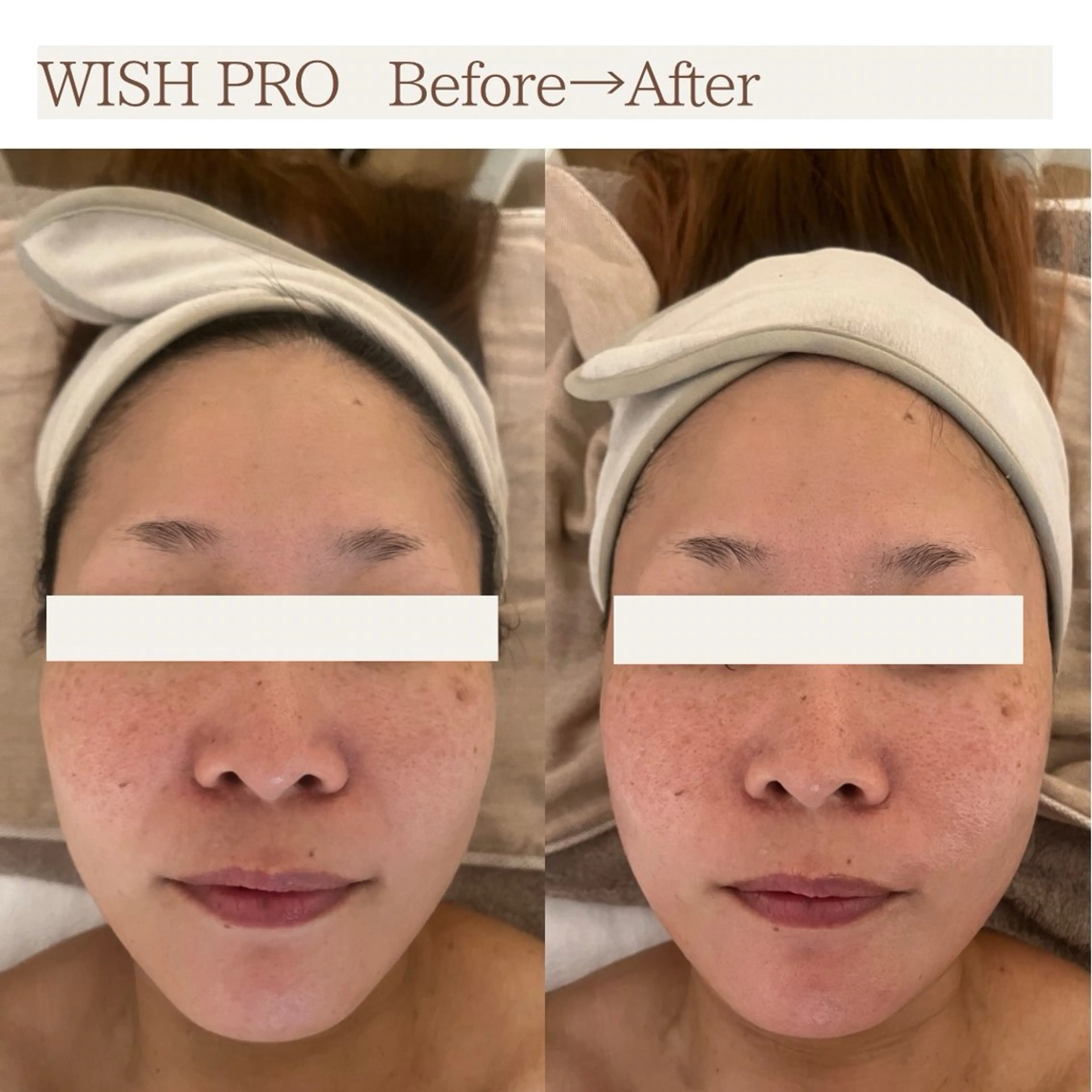 Total Beauty salon Bloom所属・肌育WISHpro 専門サロンBloomのエステ・リラクイメージ