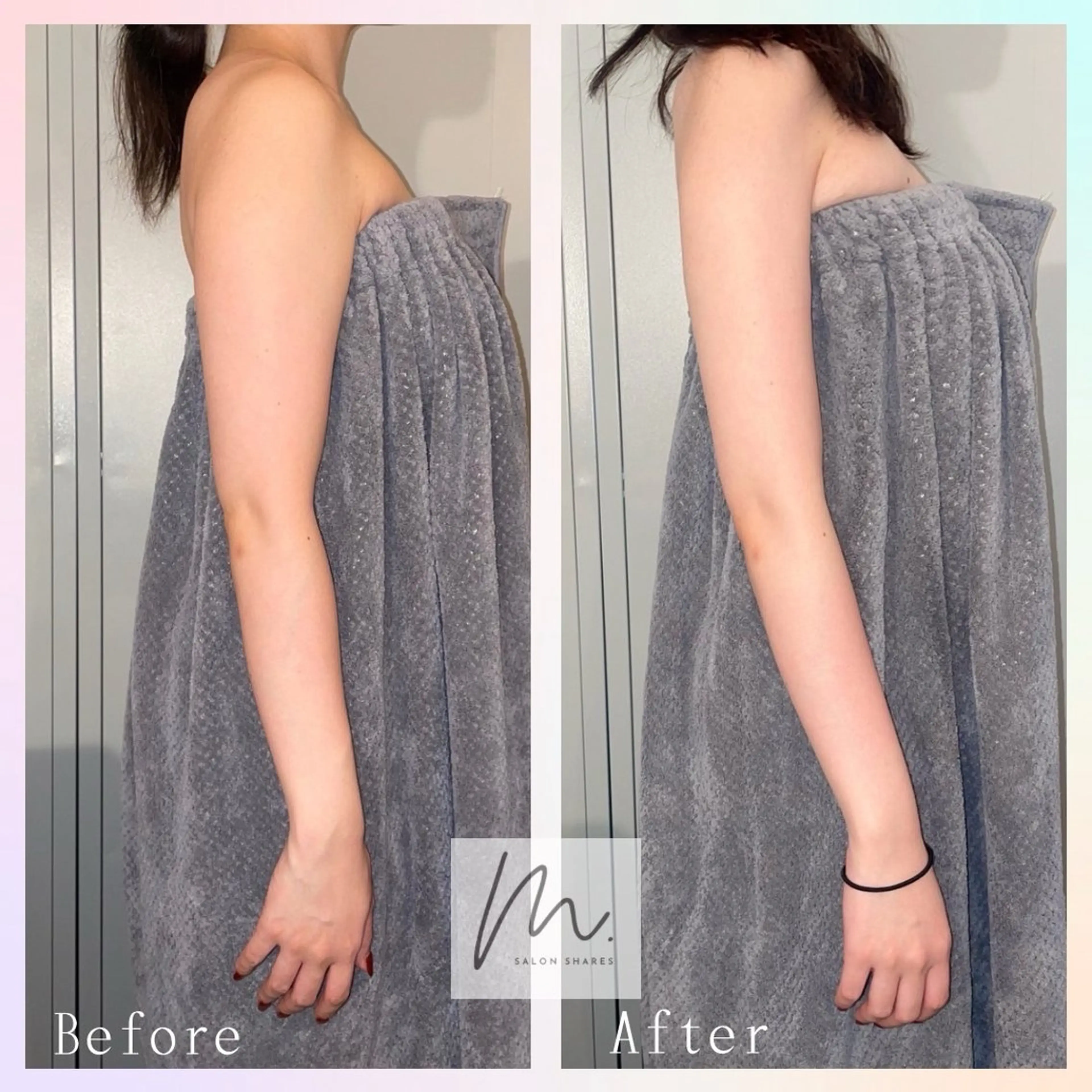 【気になる二の腕‼️】たるみ／筋肉疲労/老廃物ドバドバトリートメント/ロコミ協力必須📝SNS写真動画必須📸の写真