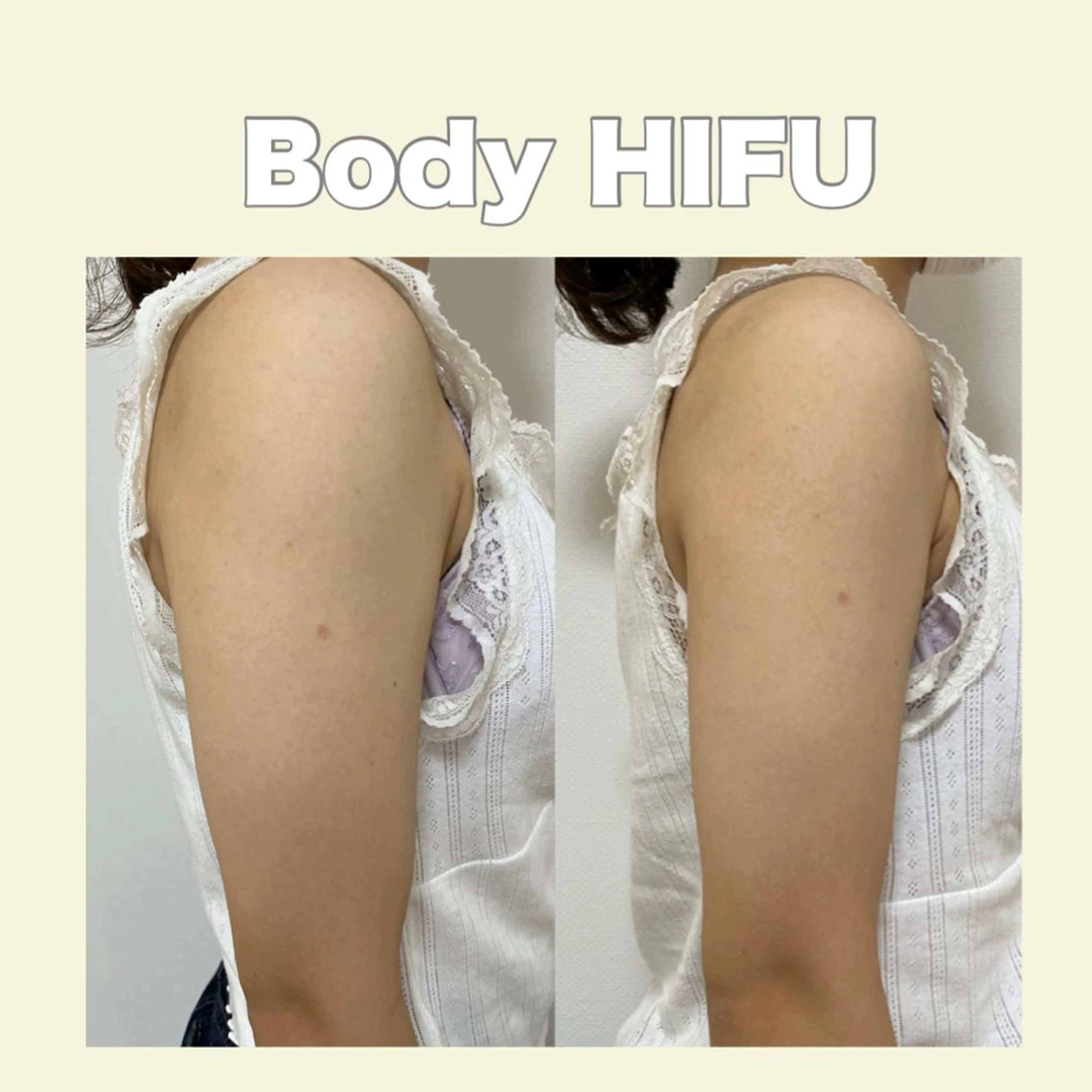 エステ 藤本 真心のネイルデザイン