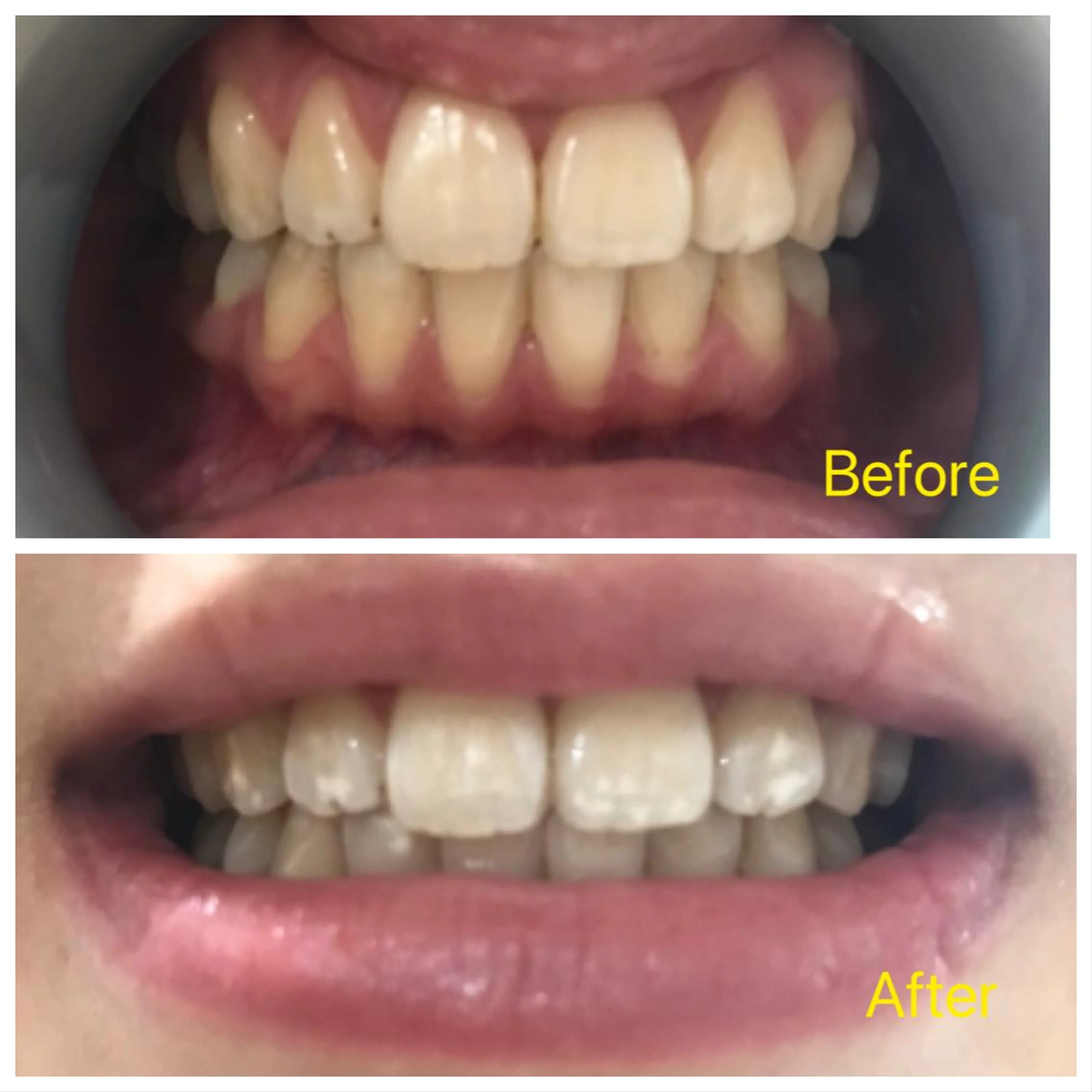 M渋谷店所属・M渋谷 ホワイトニングのエステ・リラクイメージ