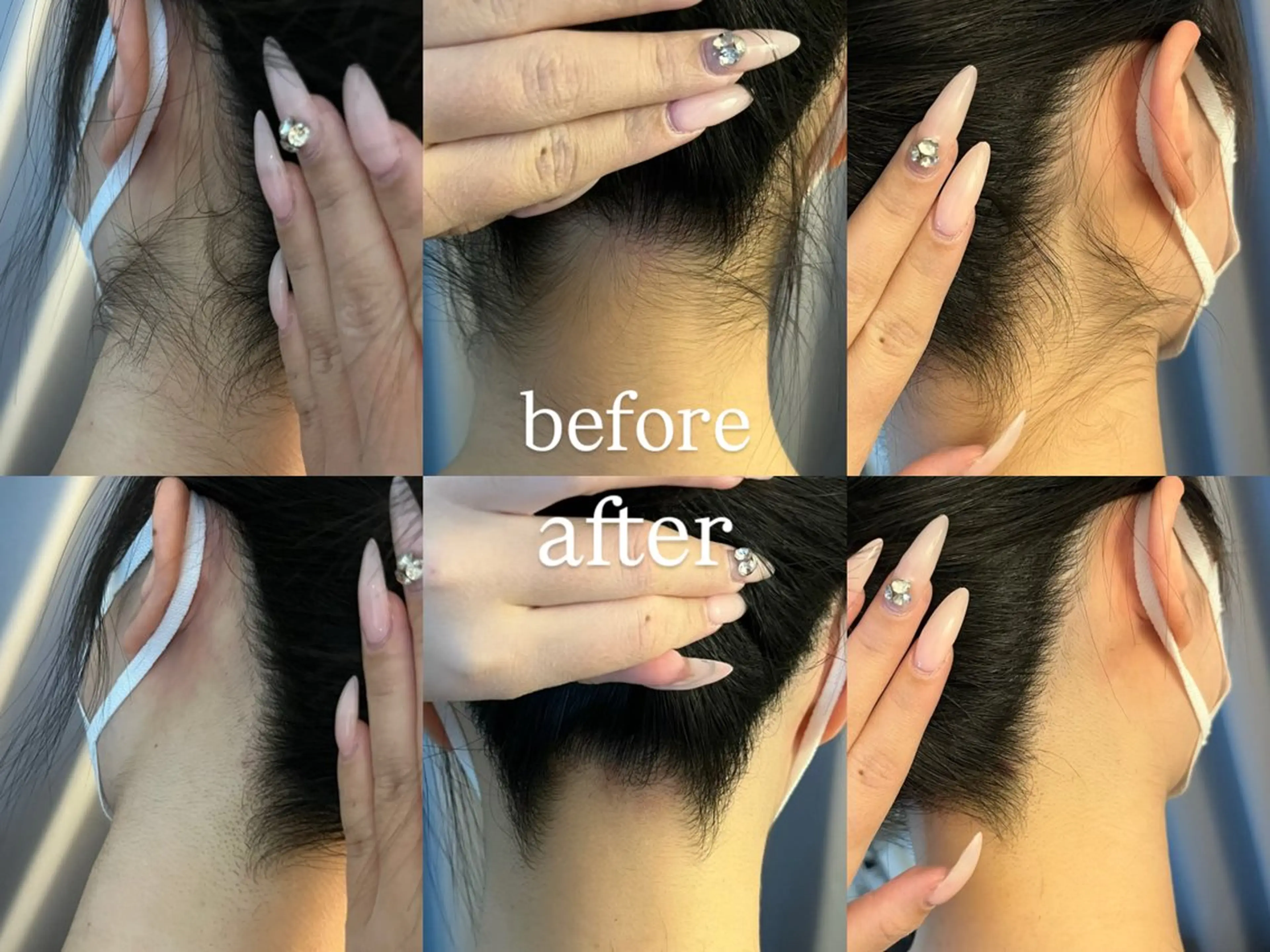 脱毛 うなじ脱毛/美肌脱毛 LABELのエステ・リラクイメージ