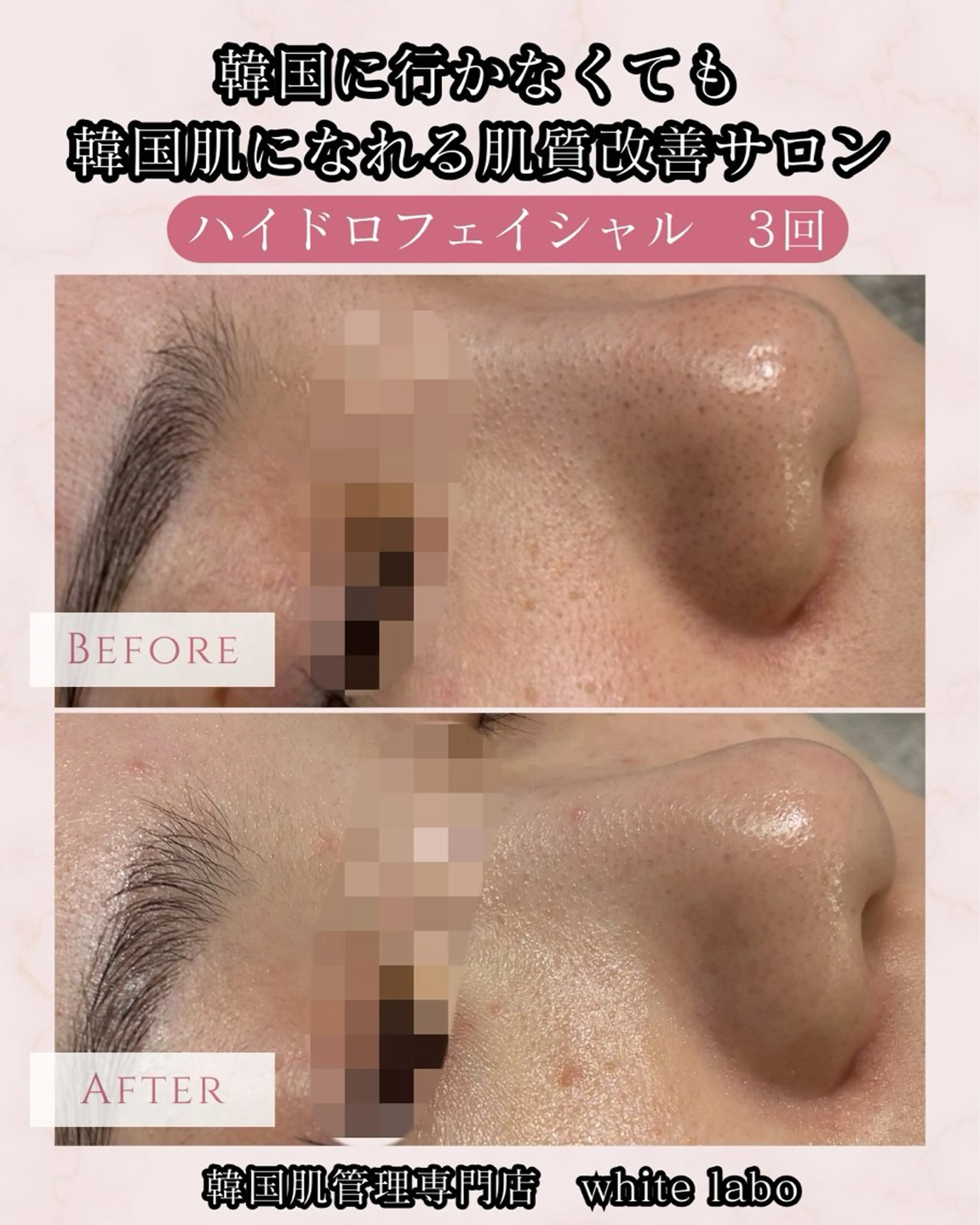 韓国肌管理専門店　White labo 梅田店所属・大西 亜季のエステ・リラクイメージ