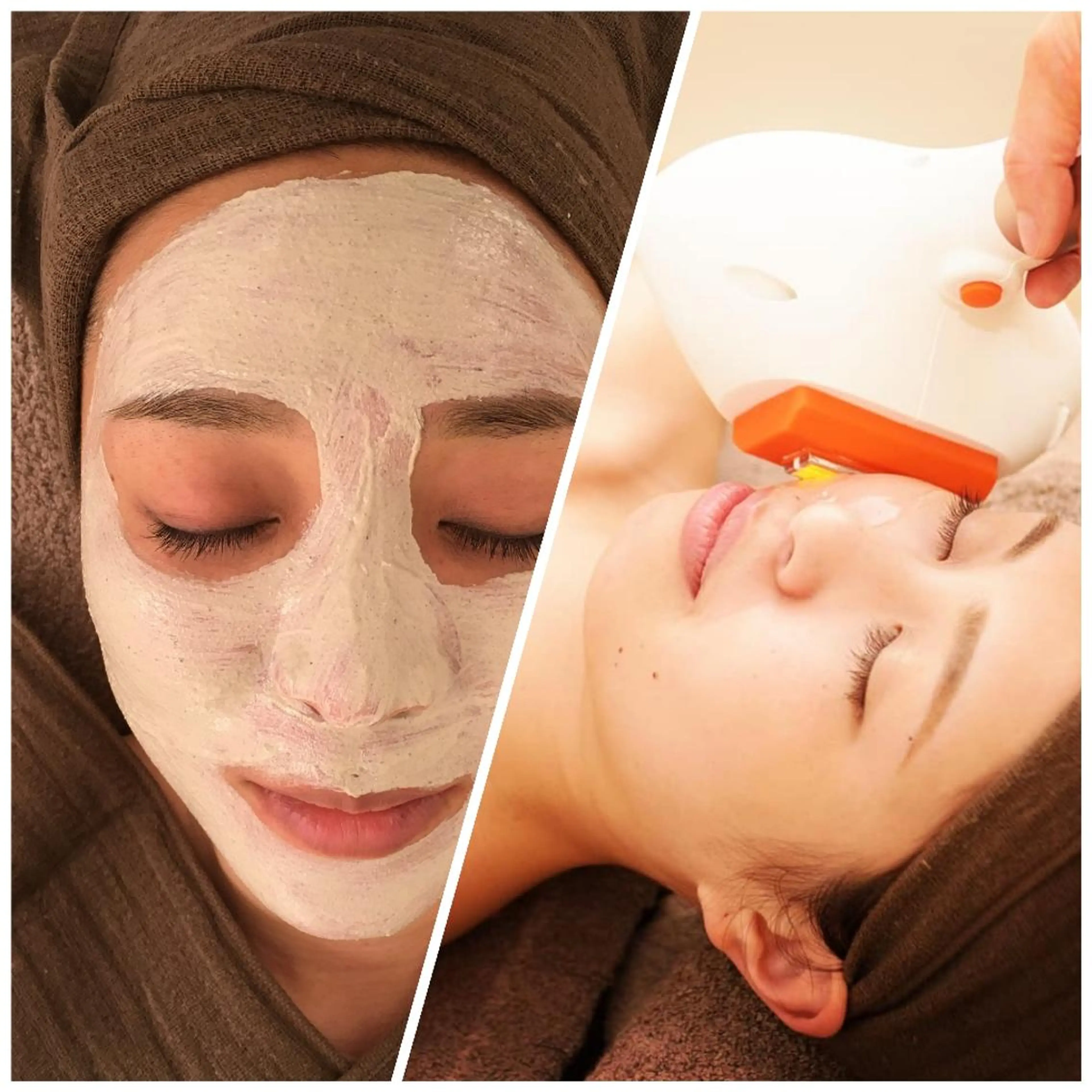 【角質毛穴集中ケア】光フェイシャル+ピーリング 120分 ¥17580→¥11000の写真