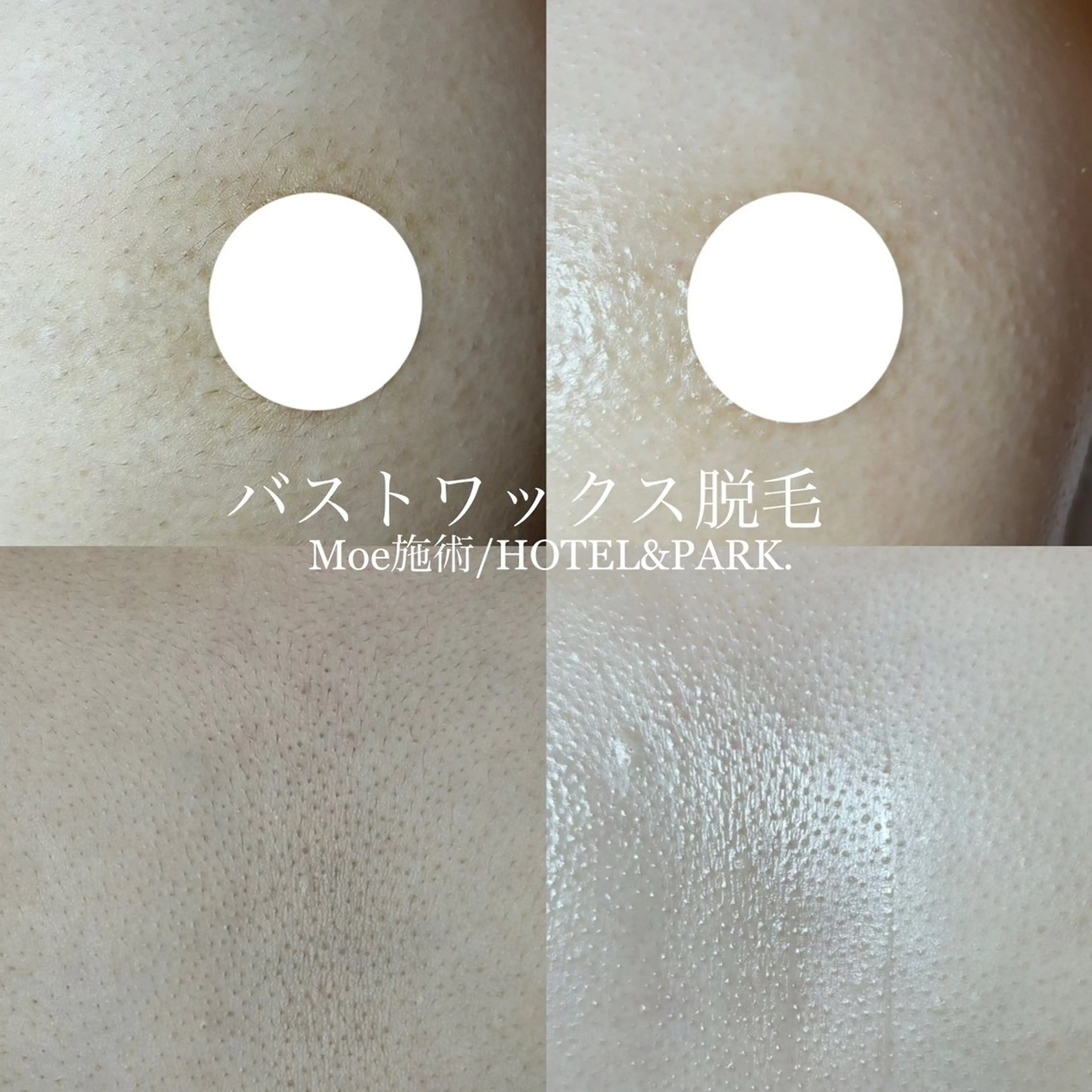 HOTEL&PARK .Moeワックス脱毛のエステ・リラクイメージ