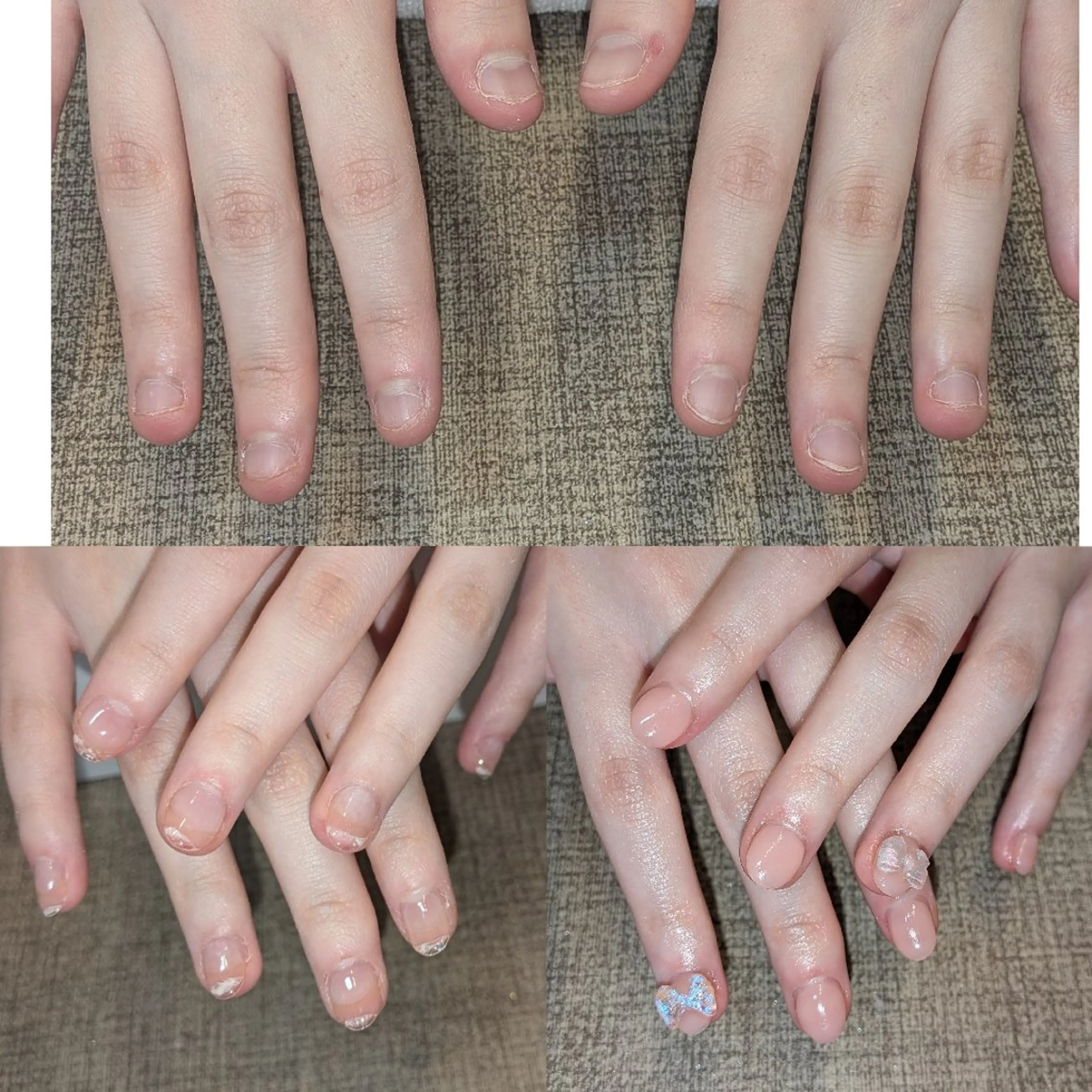 ネイル ピンク ハンドネイル ハンドケア フィルイン、長さ出し 深爪矯正のネイルデザイン