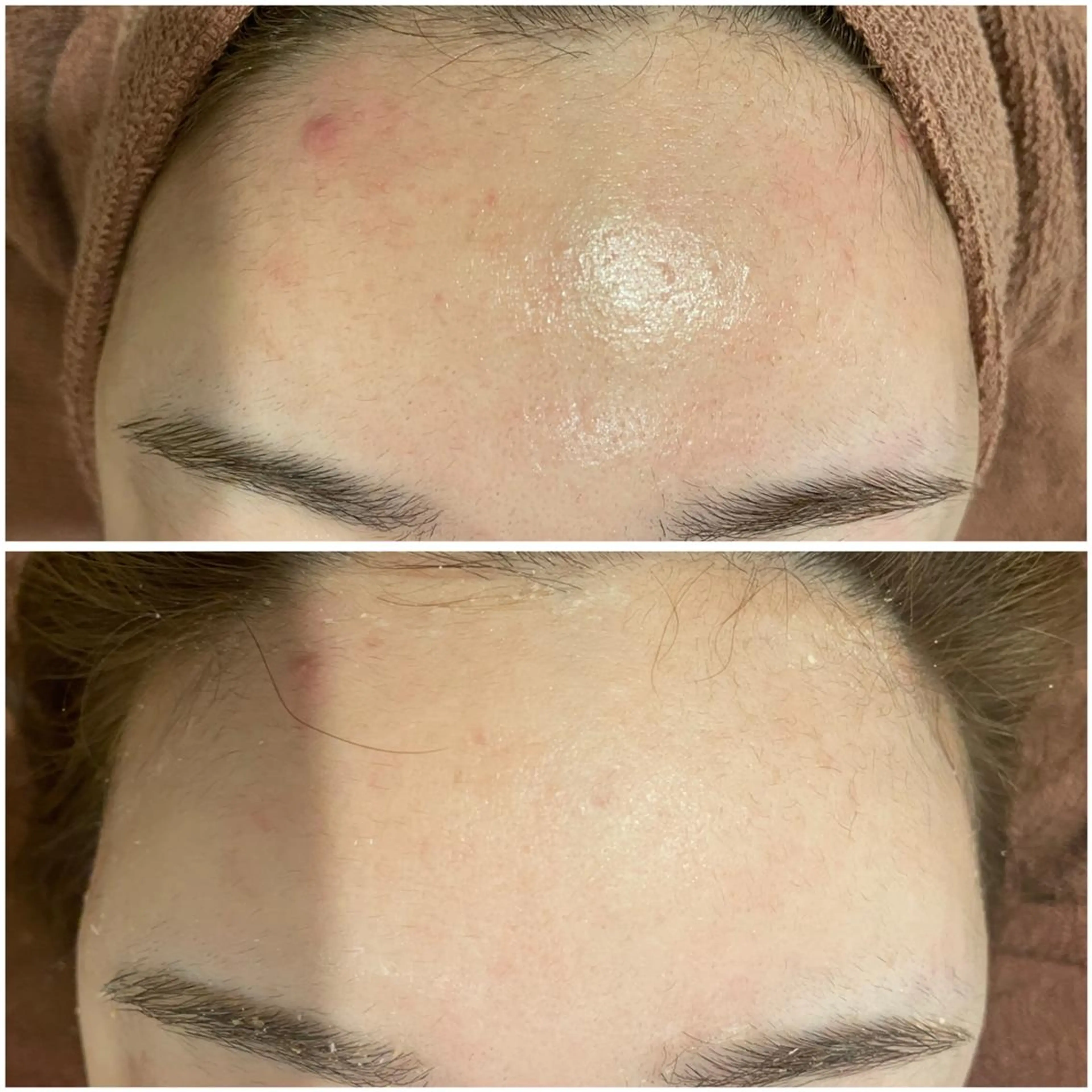 🔥3か月で肌革命 🔥ニキビ専門店のエステ・リラクイメージ