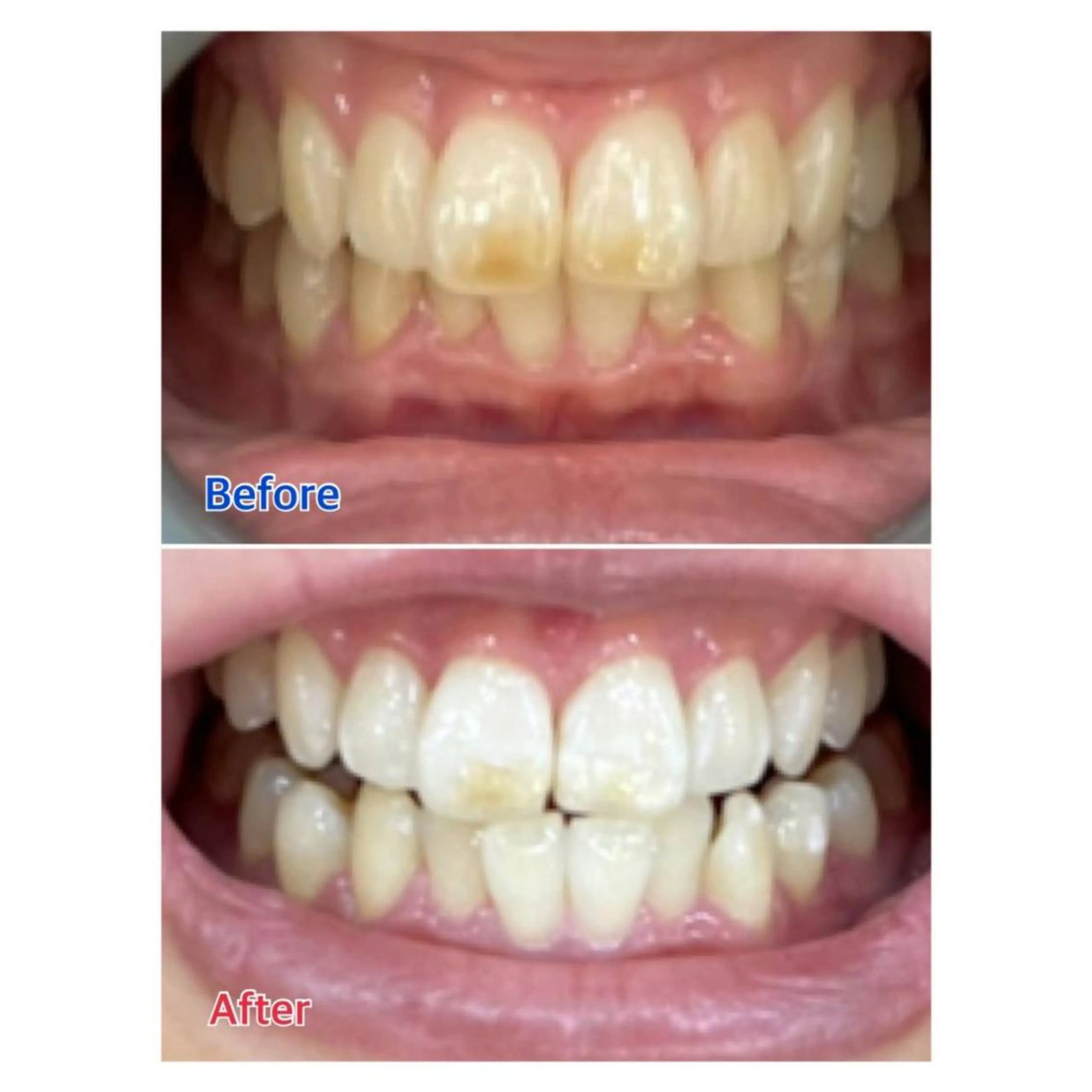 MBEAUTYSALON 千葉店・京成大久保所属・Melty 輝のその他イメージ