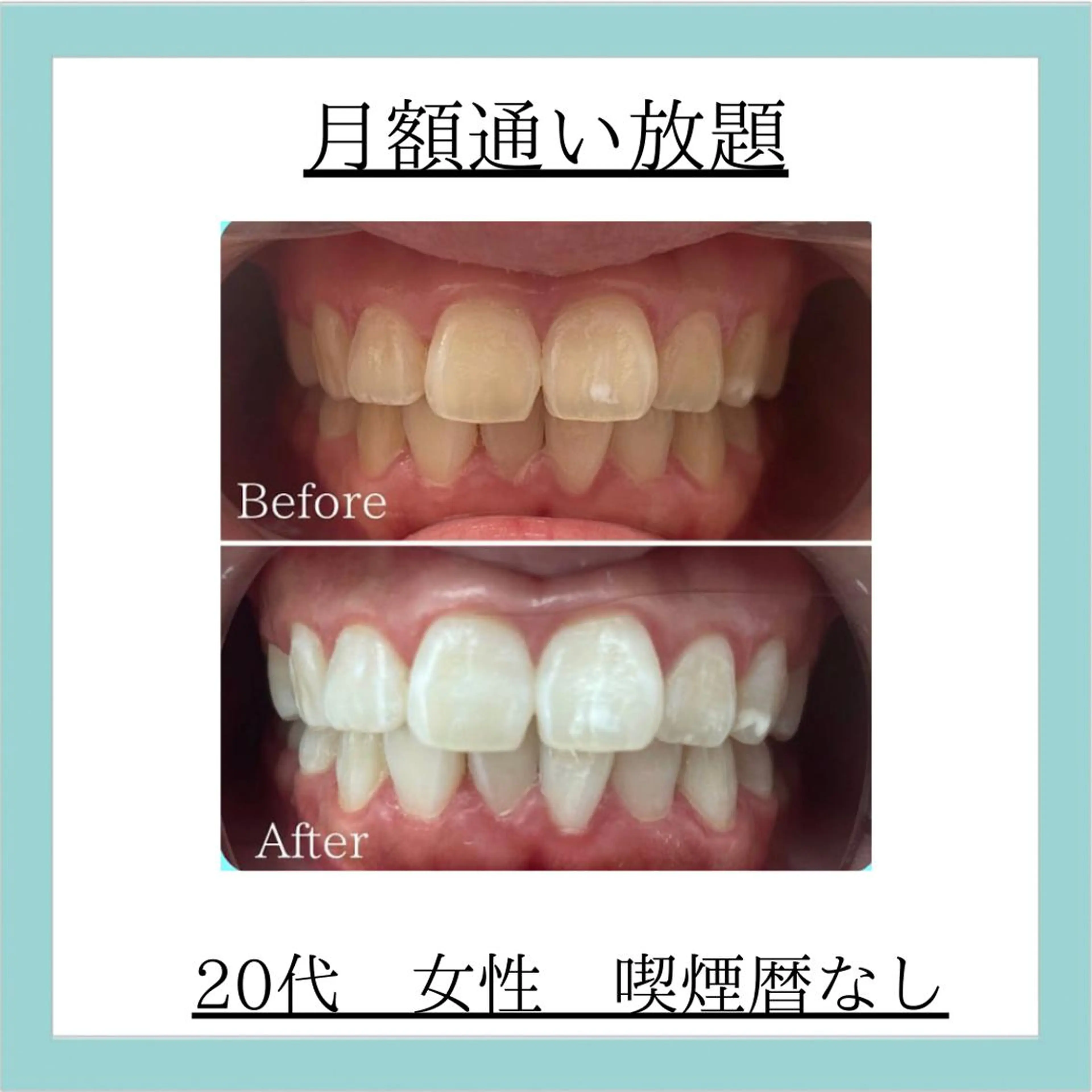 エステ リラク ホワイトニング専門店 WHITE天神店のエステ・リラクイメージ