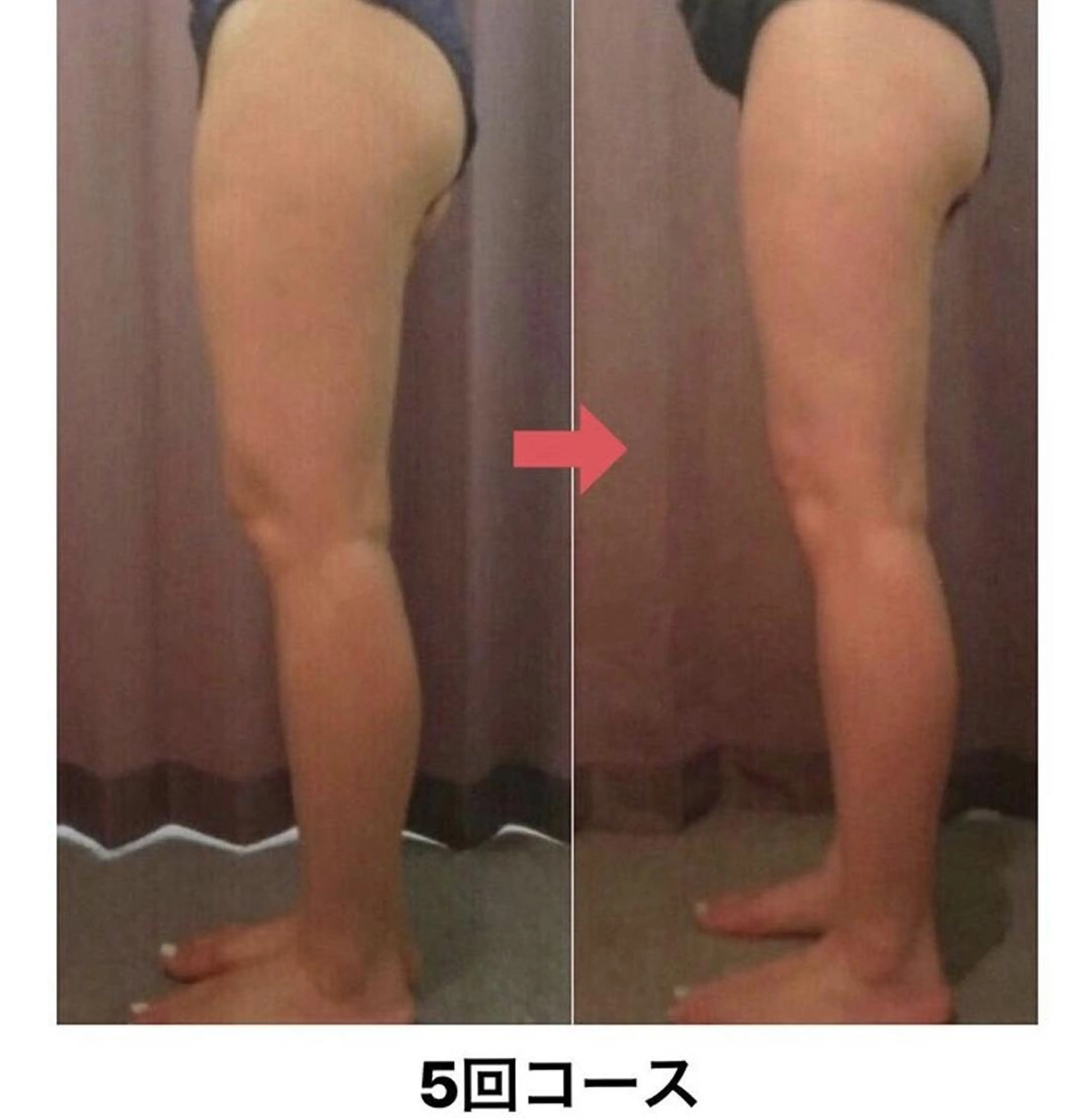 横浜エステサロン R-ing　リングのエステ・リラクイメージ