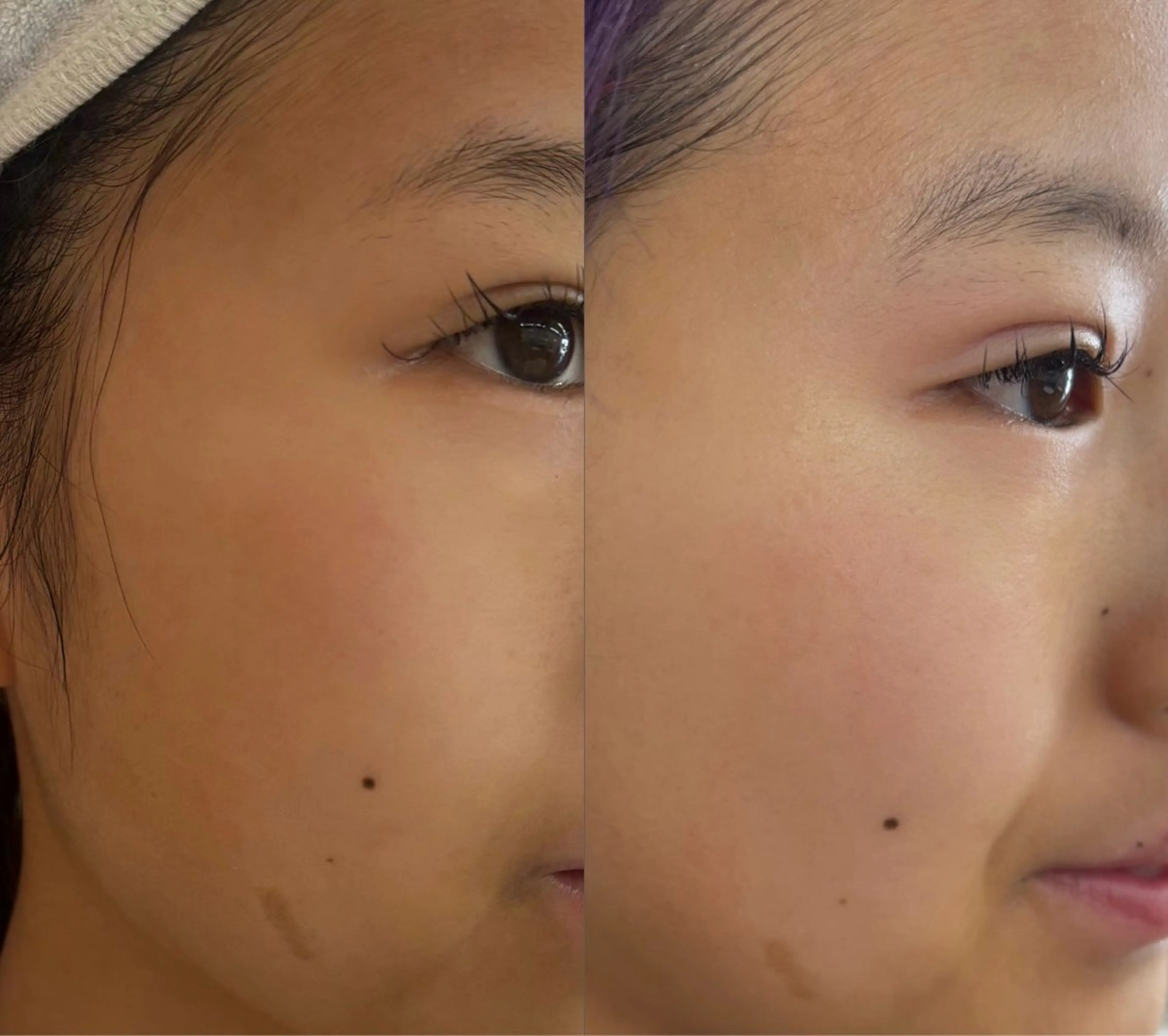 フェイシャルエステ初回500円！の写真