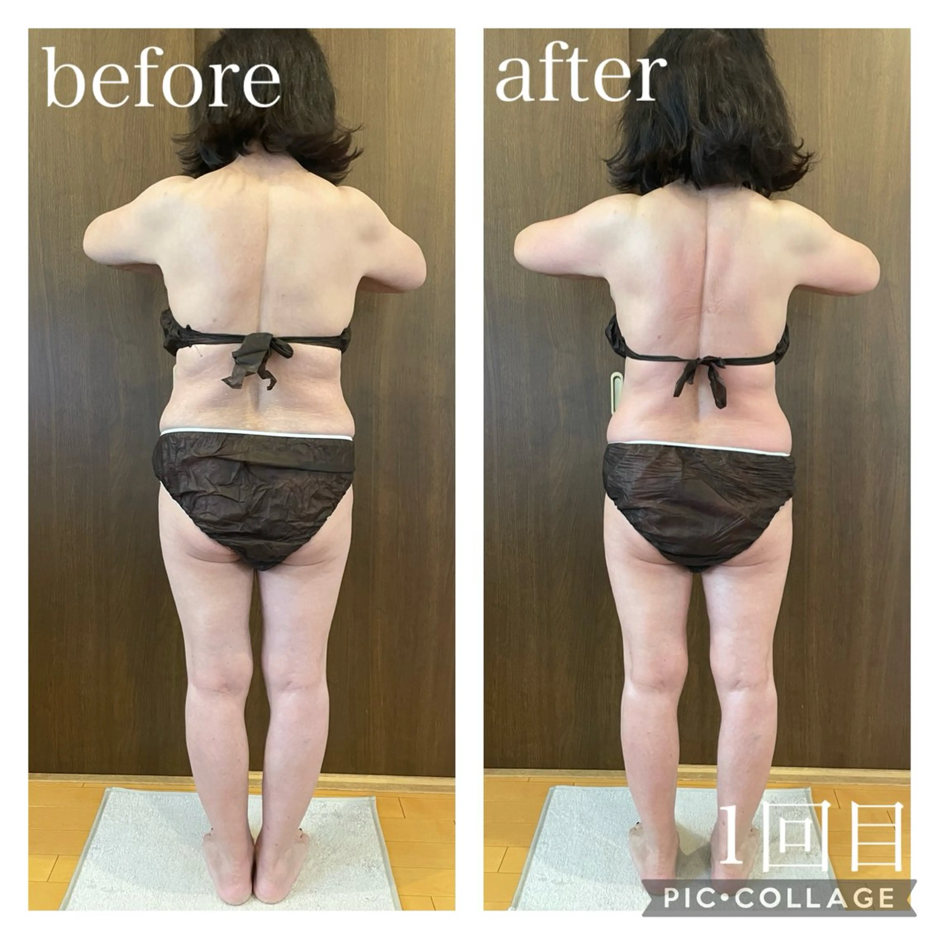 美筋シェイプボディの写真