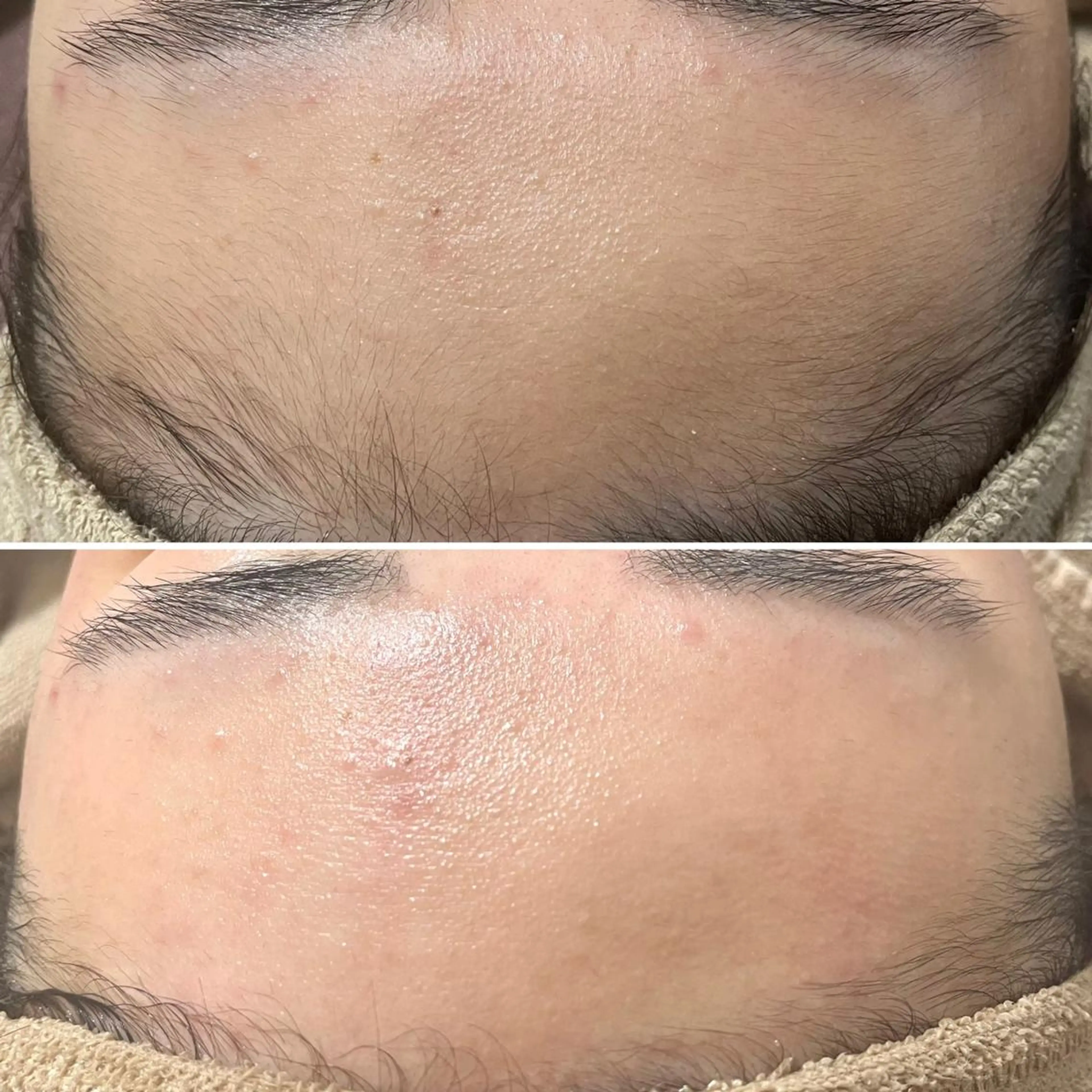 アイブロウ キッズ メンズ Epina 千葉店 【エピナ】のエステ・リラクイメージ