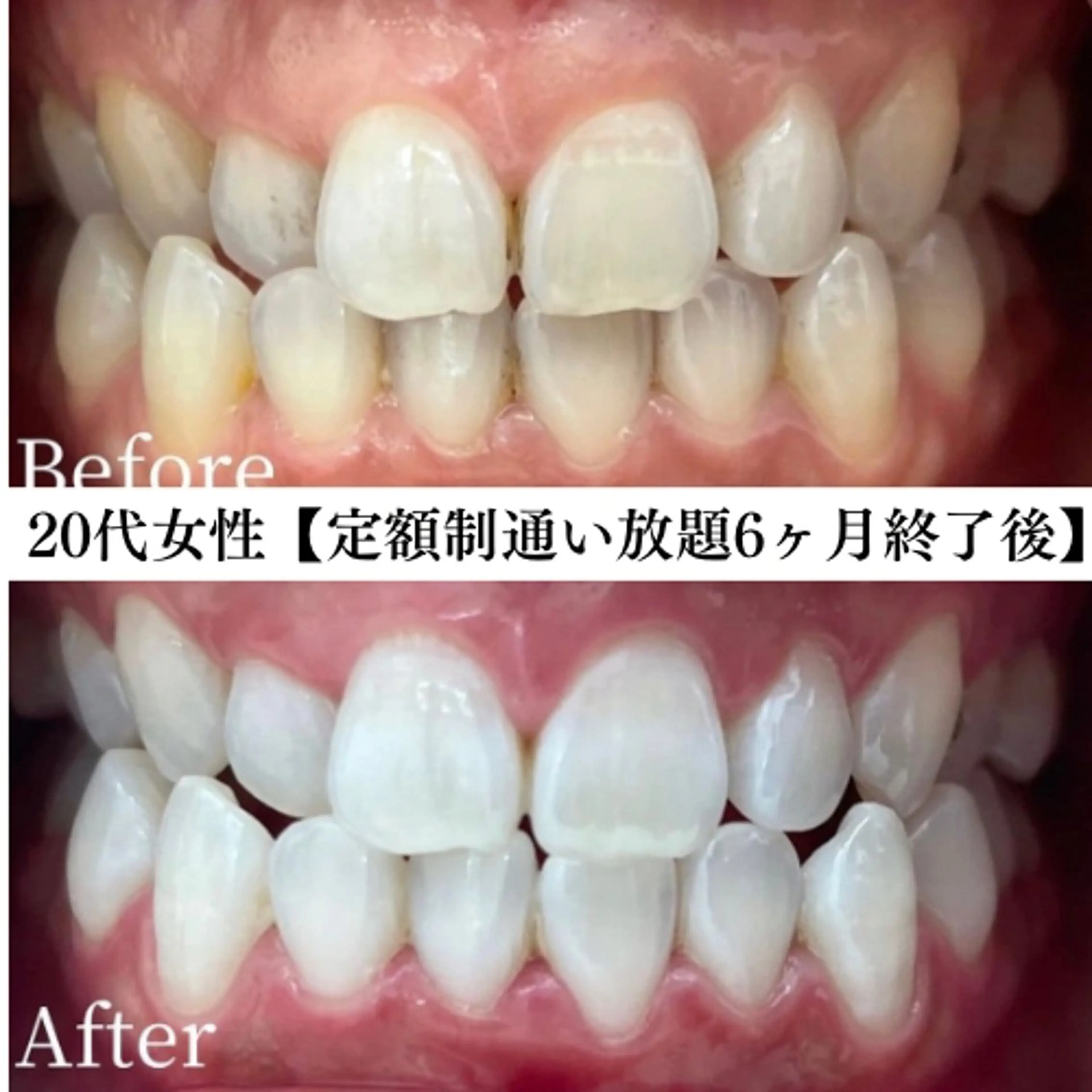 キッズ メンズ エステ リラク セルフホワイトニング専門店WHITE福岡天神店所属・セルフホワイト専門店 WHITE福岡天神店のエステ・リラクイメージ