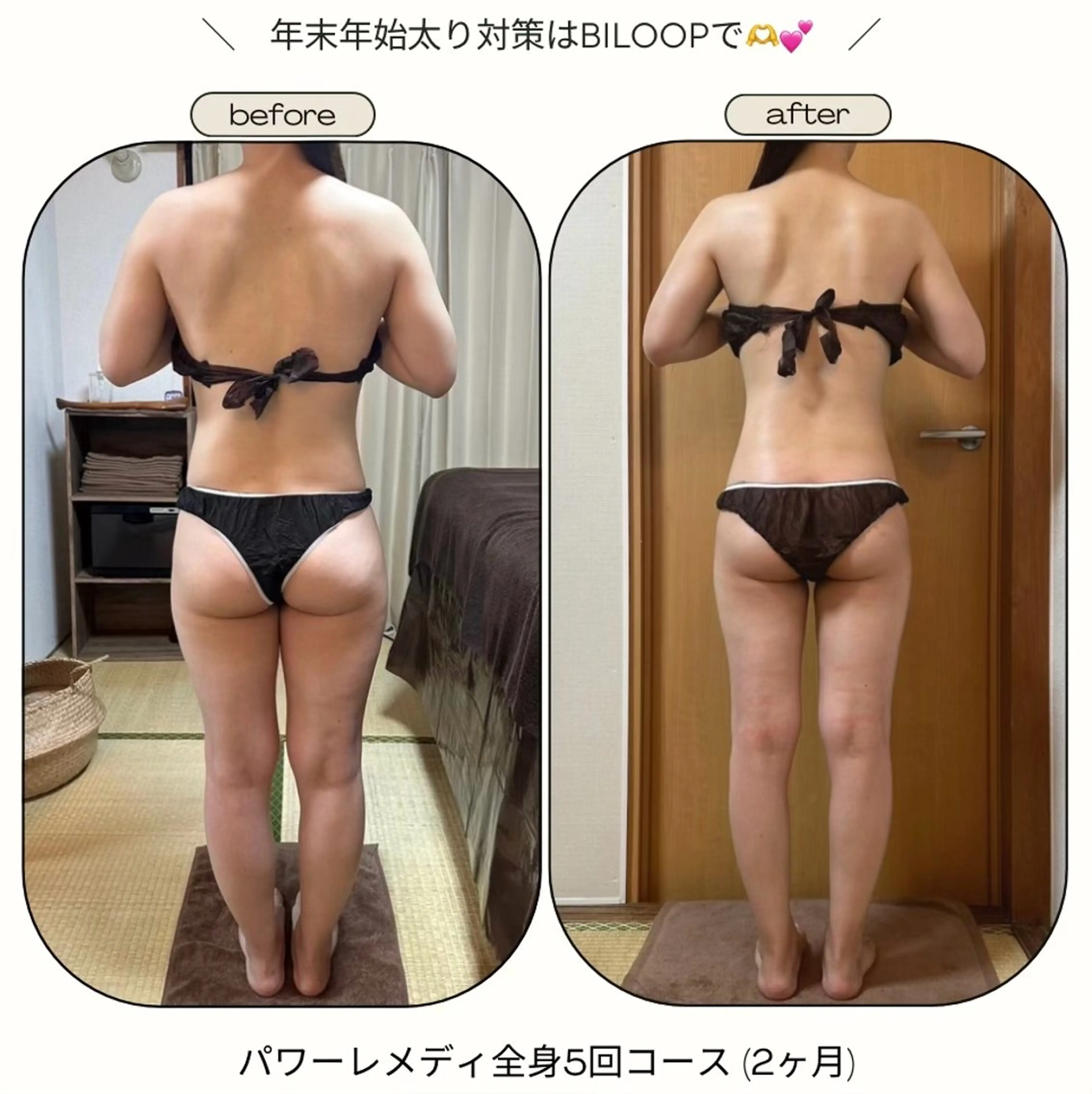 biloop所属・《本気痩せ×疲労改善 》  BILOOPのエステ・リラクイメージ