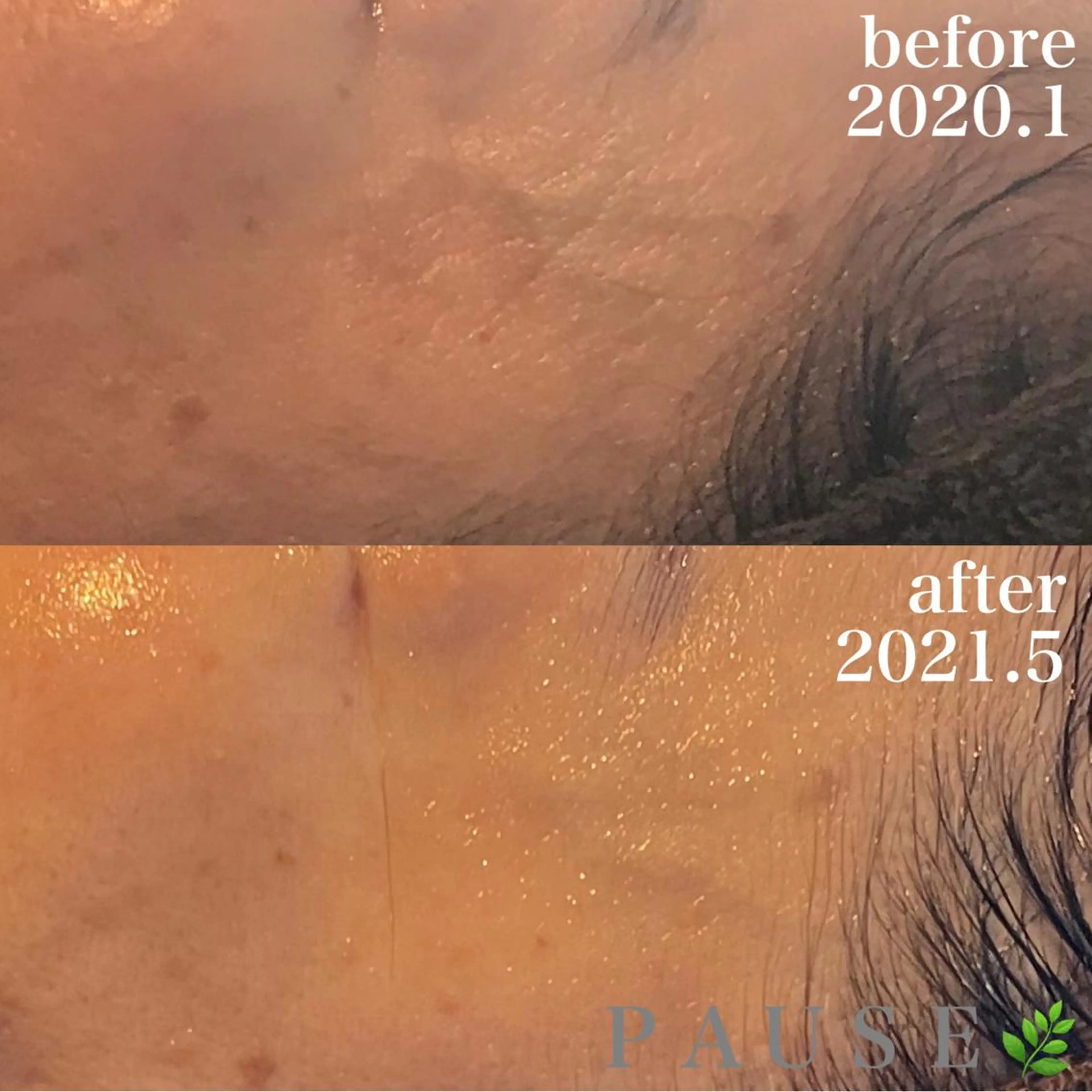 エステ 浜野 恵美のエステ・リラクイメージ