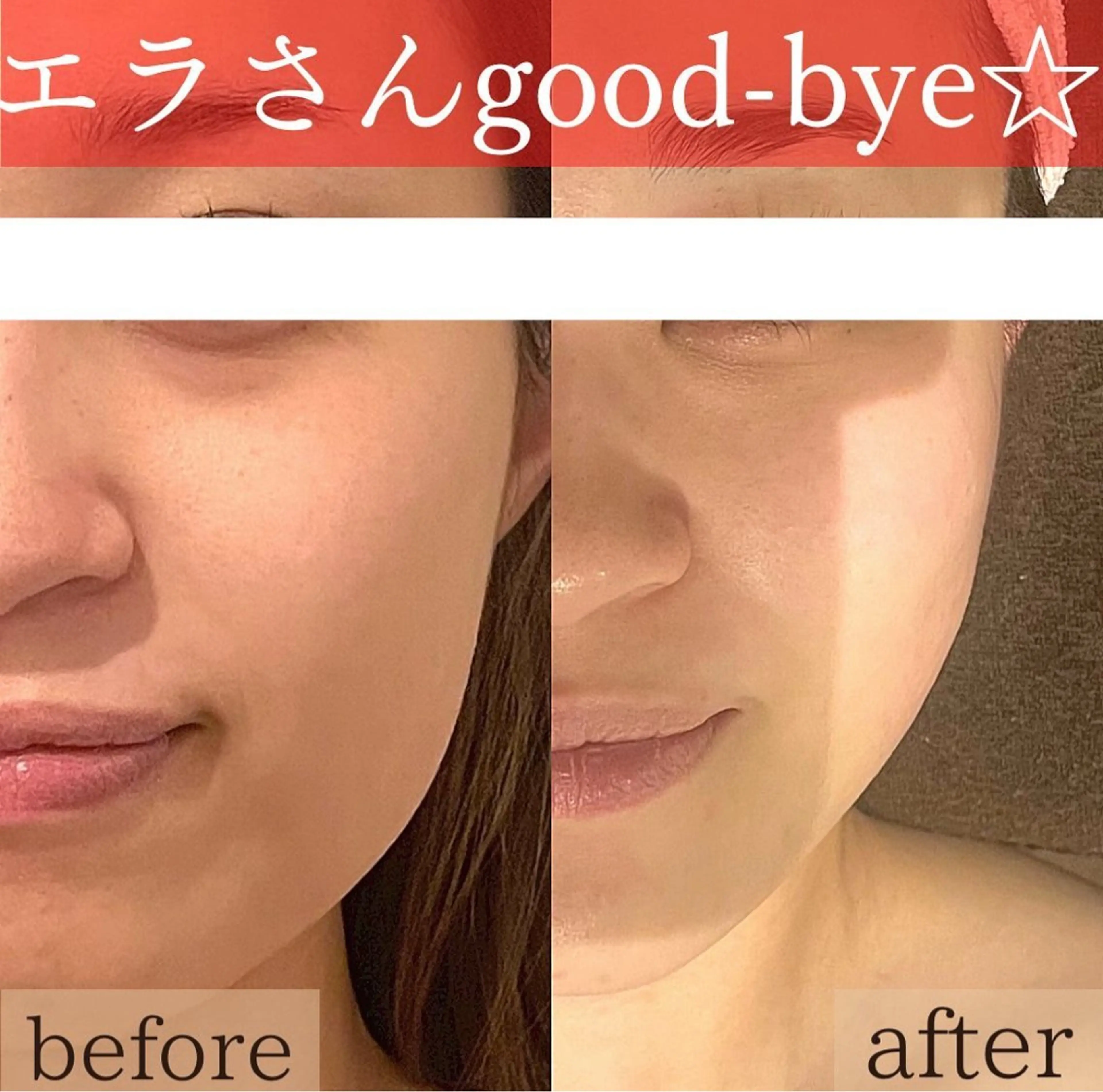 【平日×3名限定】10回で実感!結果にこだわる《こりとりコルギ》🦴💆♀️✨60分施術の写真