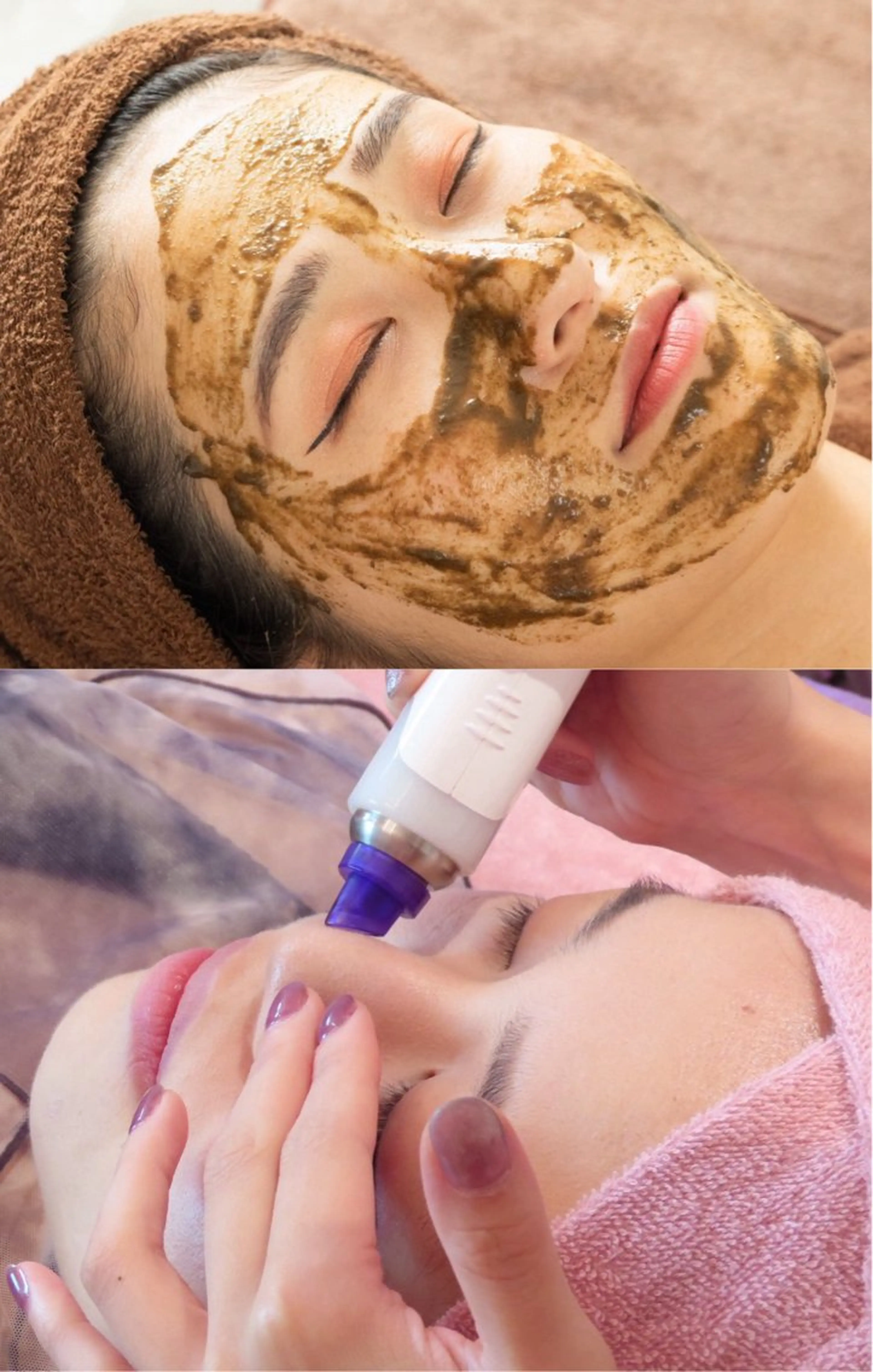 【今月限定人気No1★医師推奨/本格肌改善】幹細胞入りの独自のハーブピーリング×ハイドラ毛穴洗浄　目指せ赤ちゃん👶肌の写真