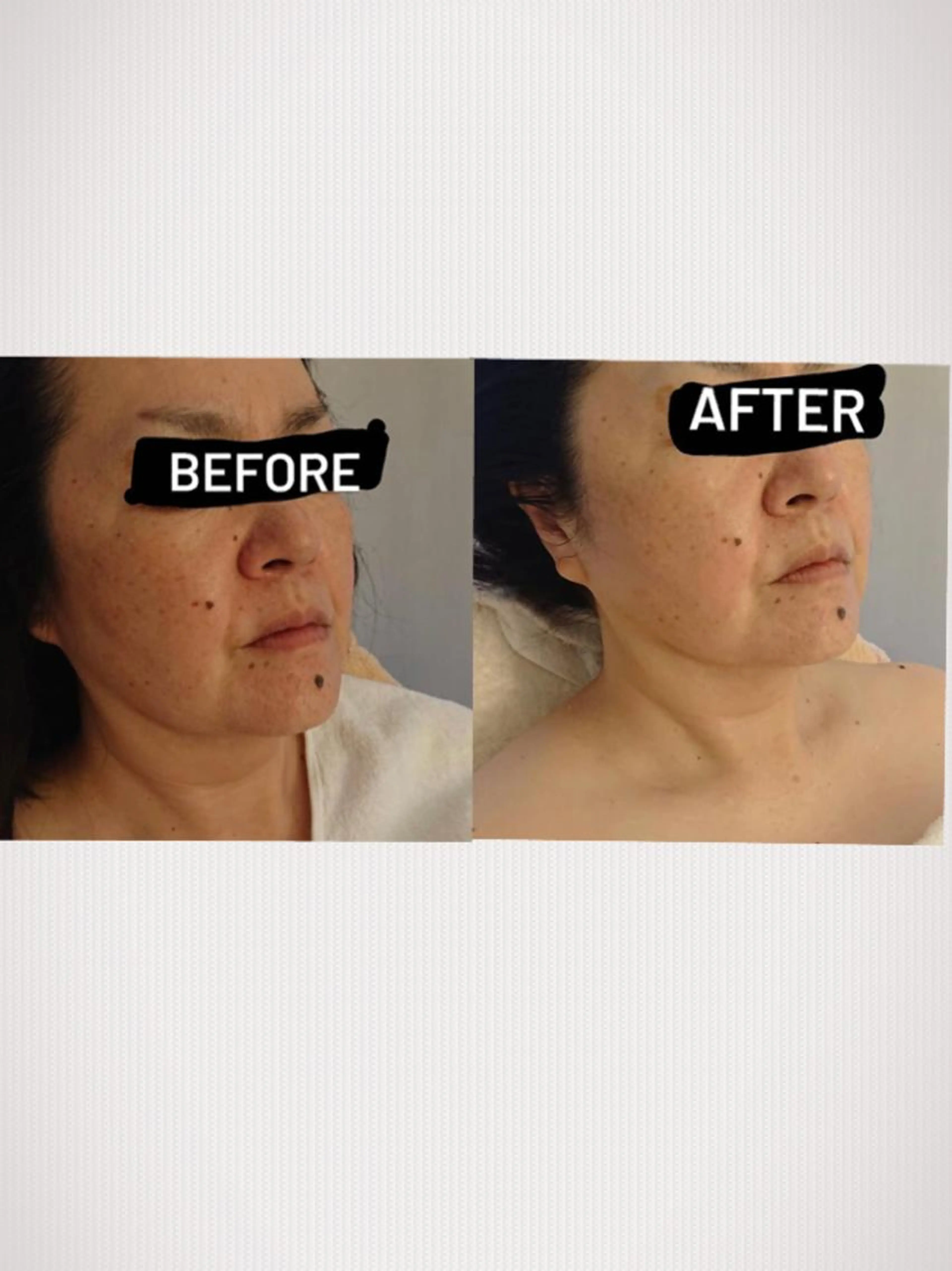 \『１日１名限定』プレミアムエステ/顔～首～肩～背中極上オールハンドマッサージ❤️至福のひと時✨自分へのご褒美❤️の写真