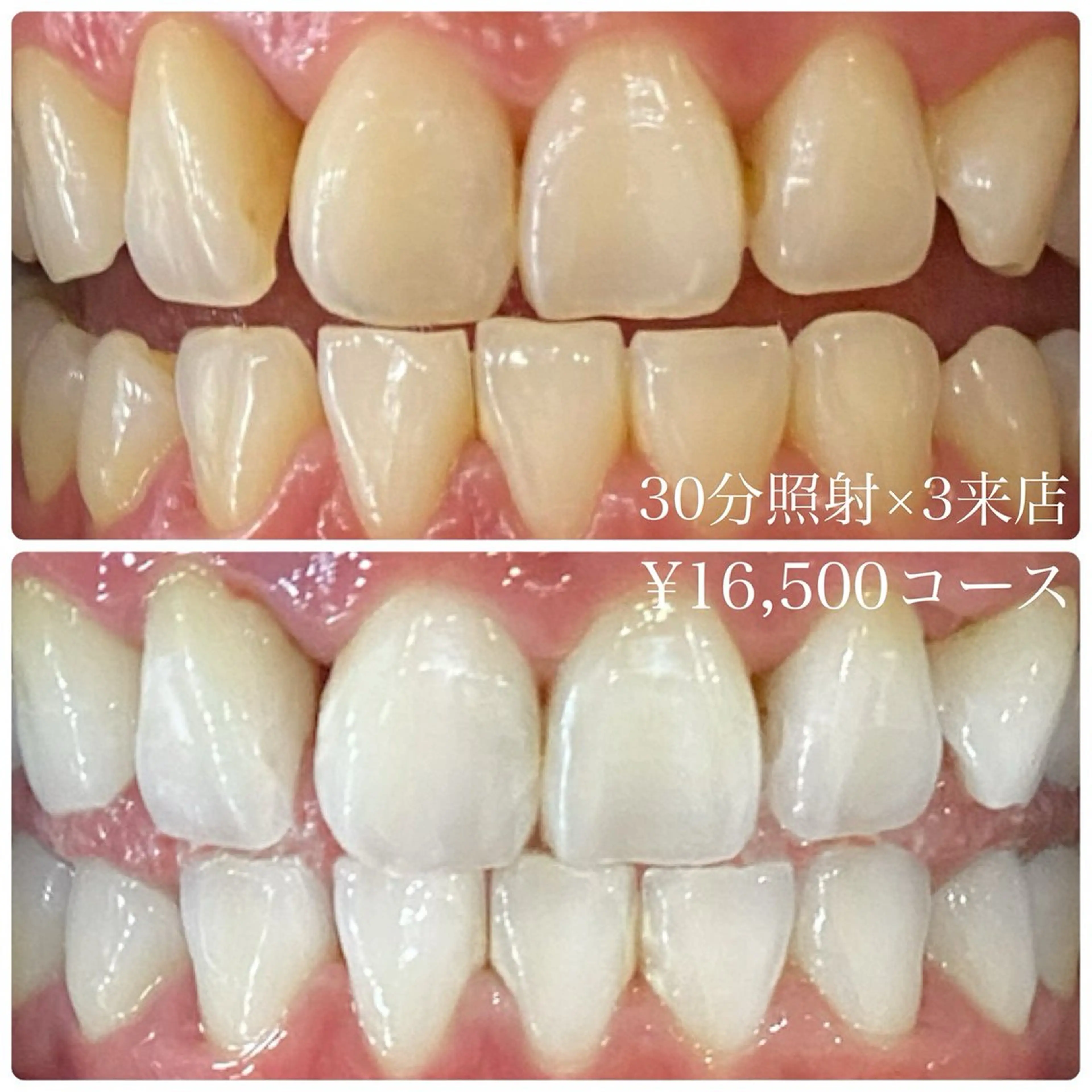 PLATINUM Beauty 横浜店所属・ホワイトニングルーム 横浜店のその他イメージ