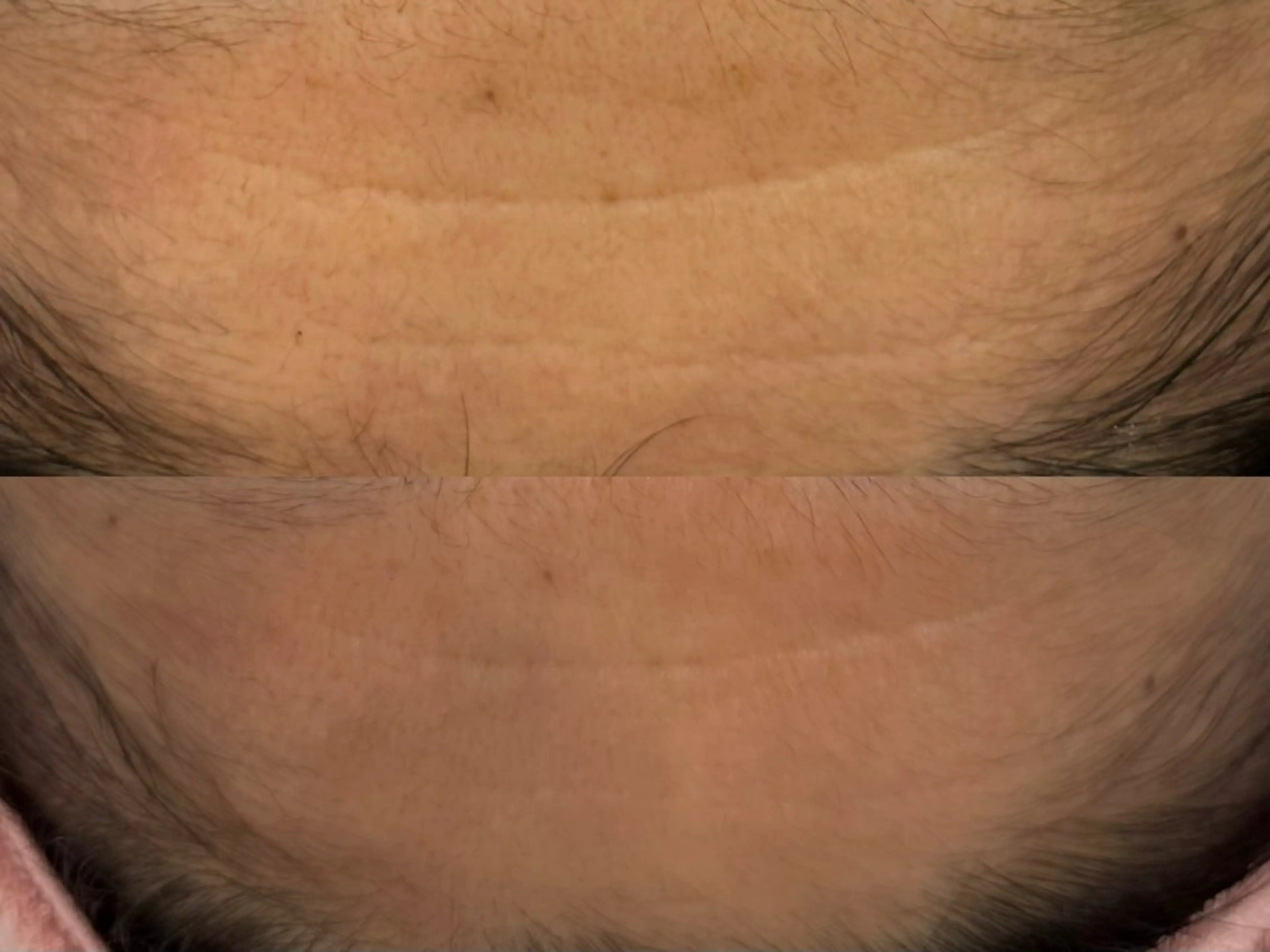 べアール所属・小顔/毛穴/ニキビ salon bealのエステ・リラクイメージ