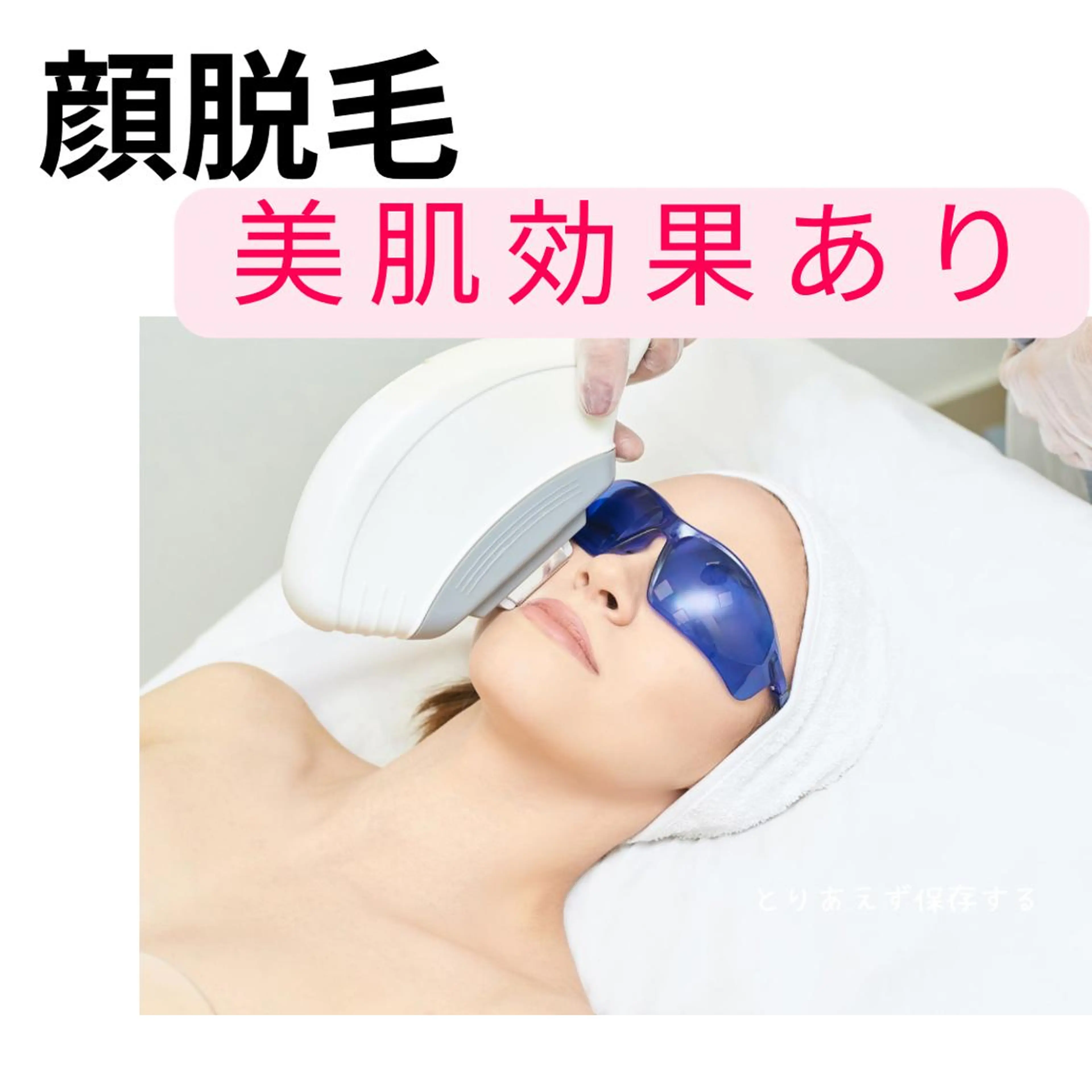 【ミニモ価格】★うるつや！顔脱毛★選べる美容パックつき！選べる美容液たっぷりパックつき！時間割引ありの写真