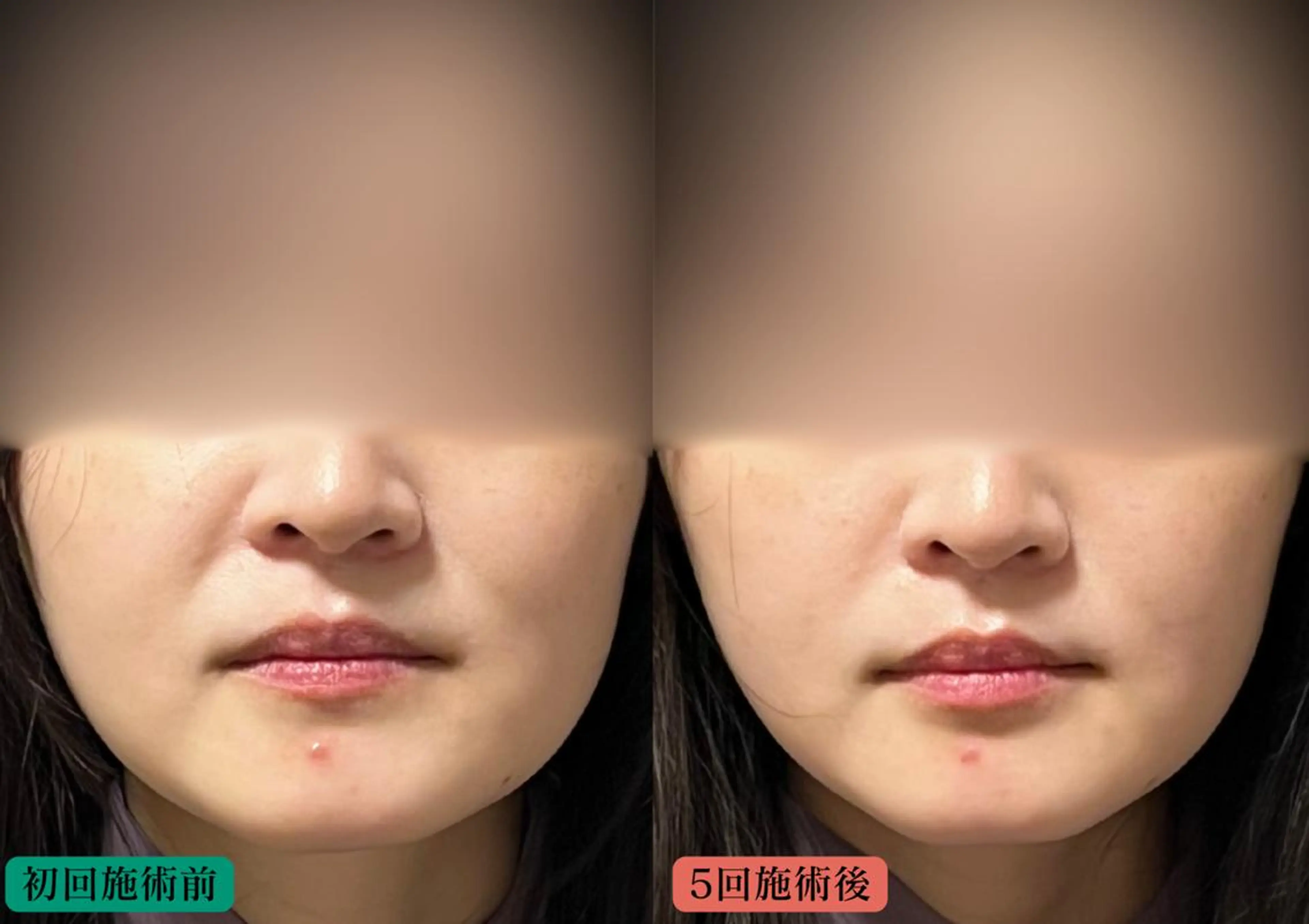 エステ リラク 美容とカラダの鍼灸 サロン やなけんのエステ・リラクイメージ