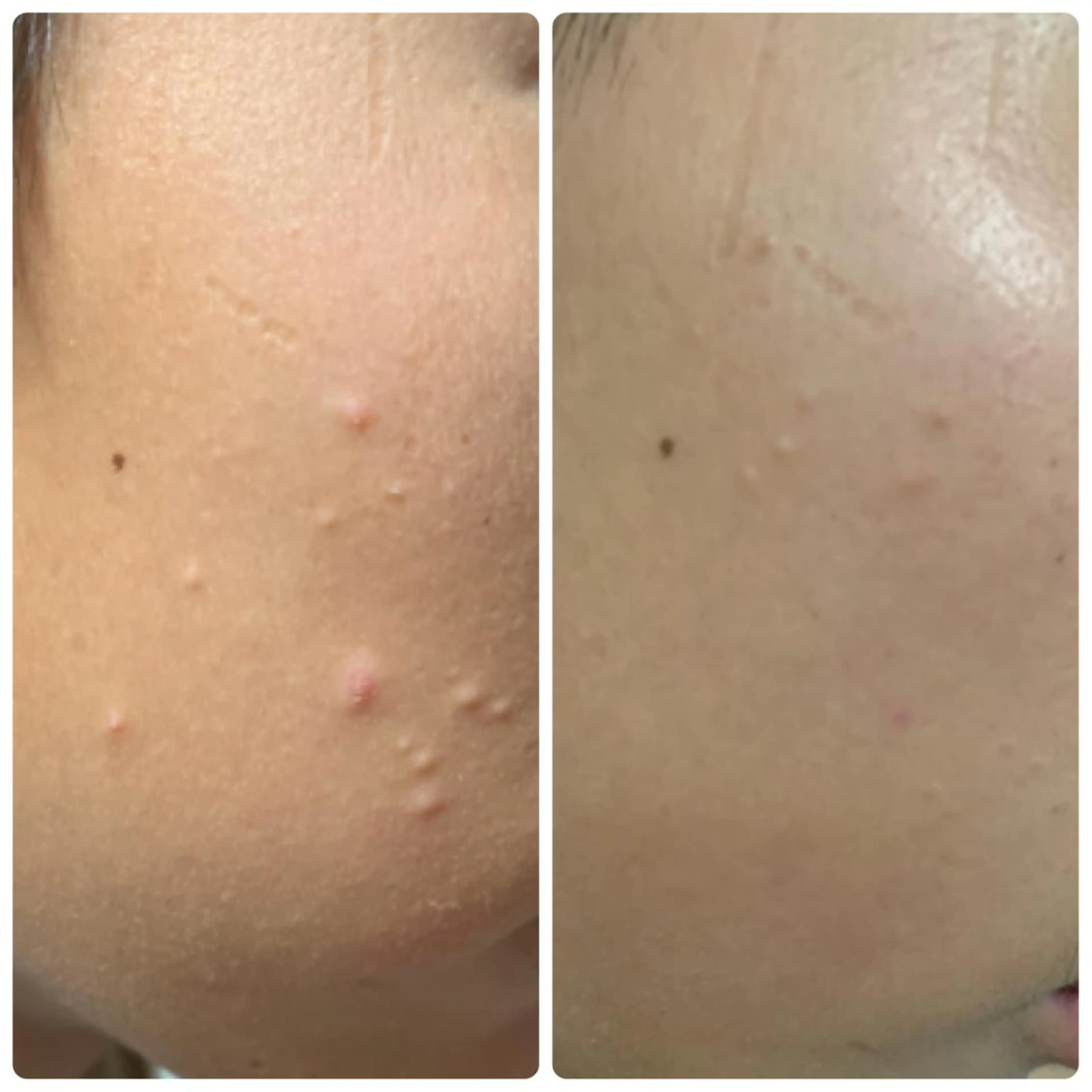 Luce所属・Luce Shokoのエステ・リラクイメージ