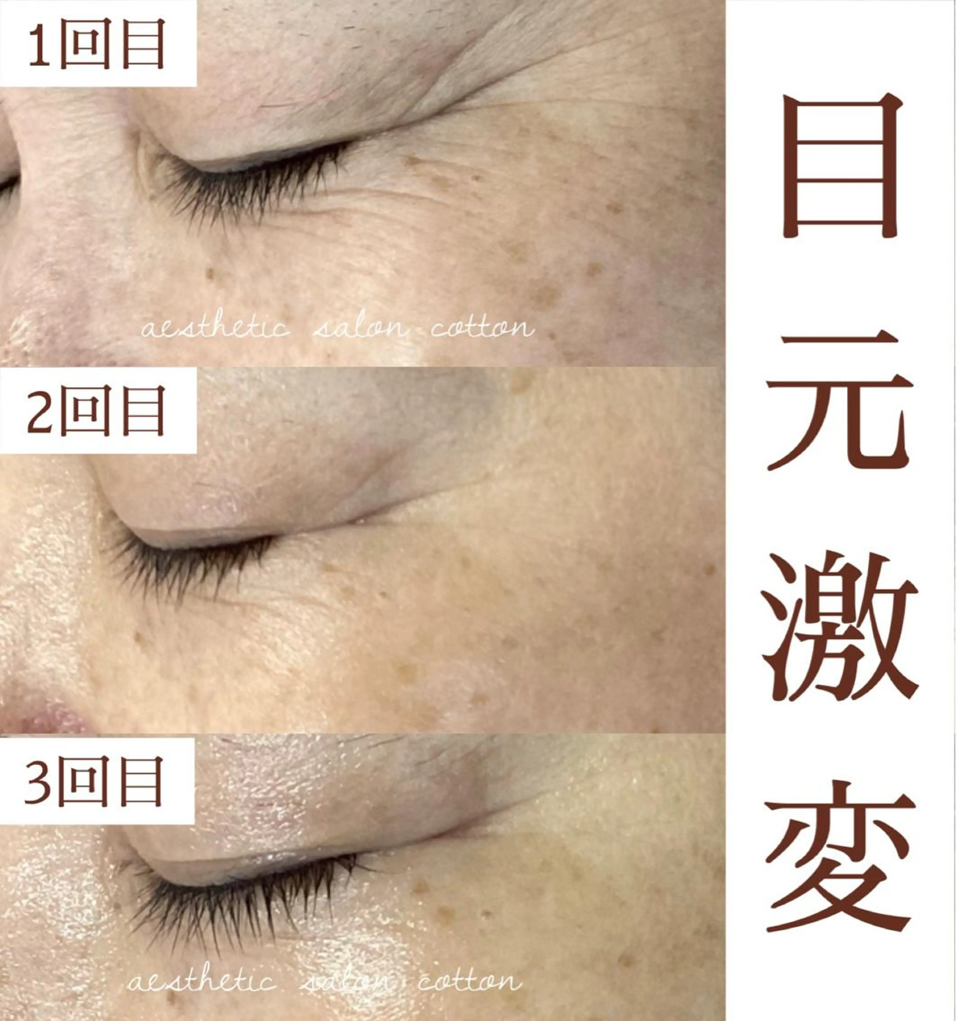 都度払い 肌質改善専門サロンのエステ・リラクイメージ