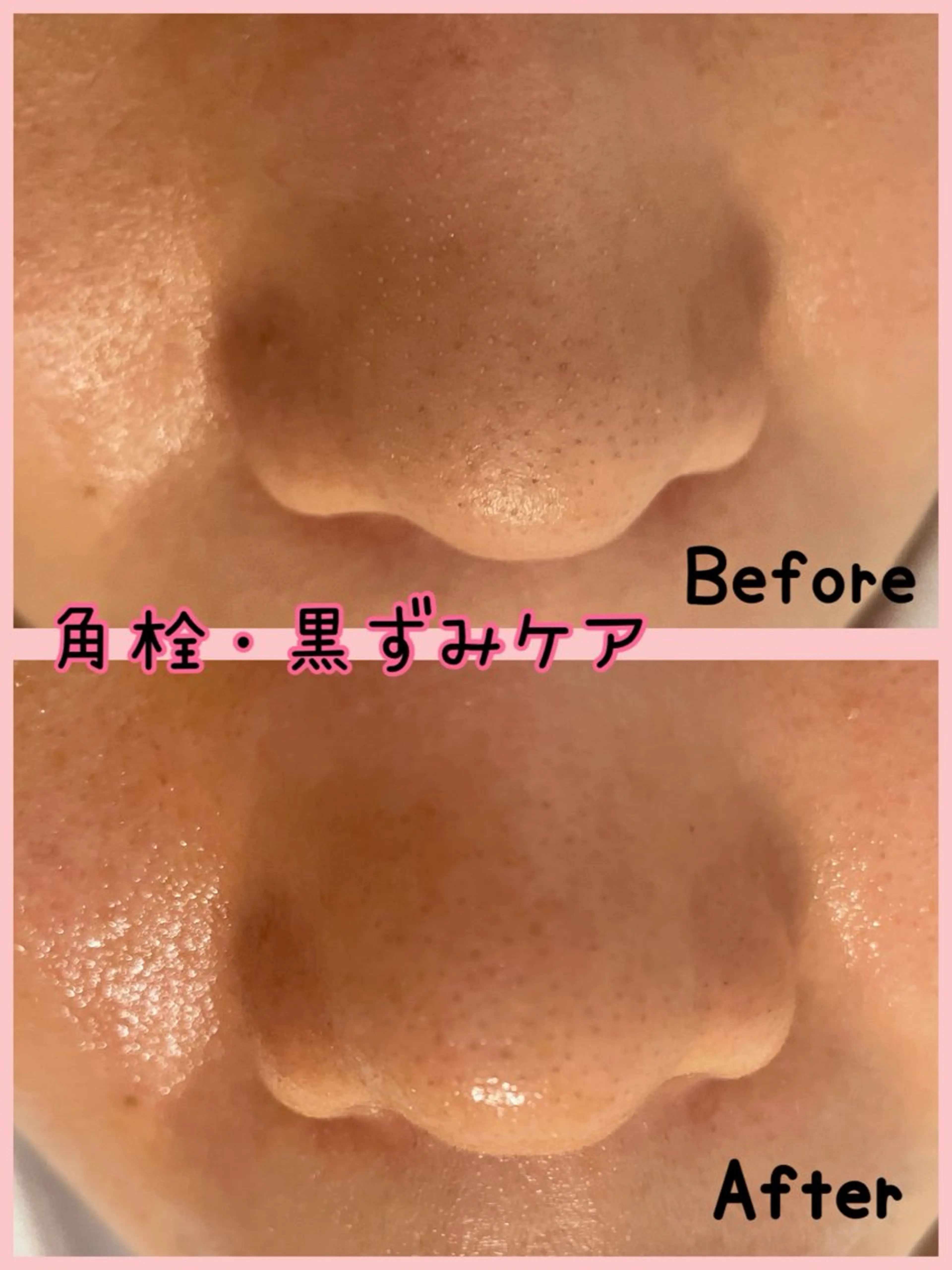 Pono所属・Pono （ポノ）のその他イメージ