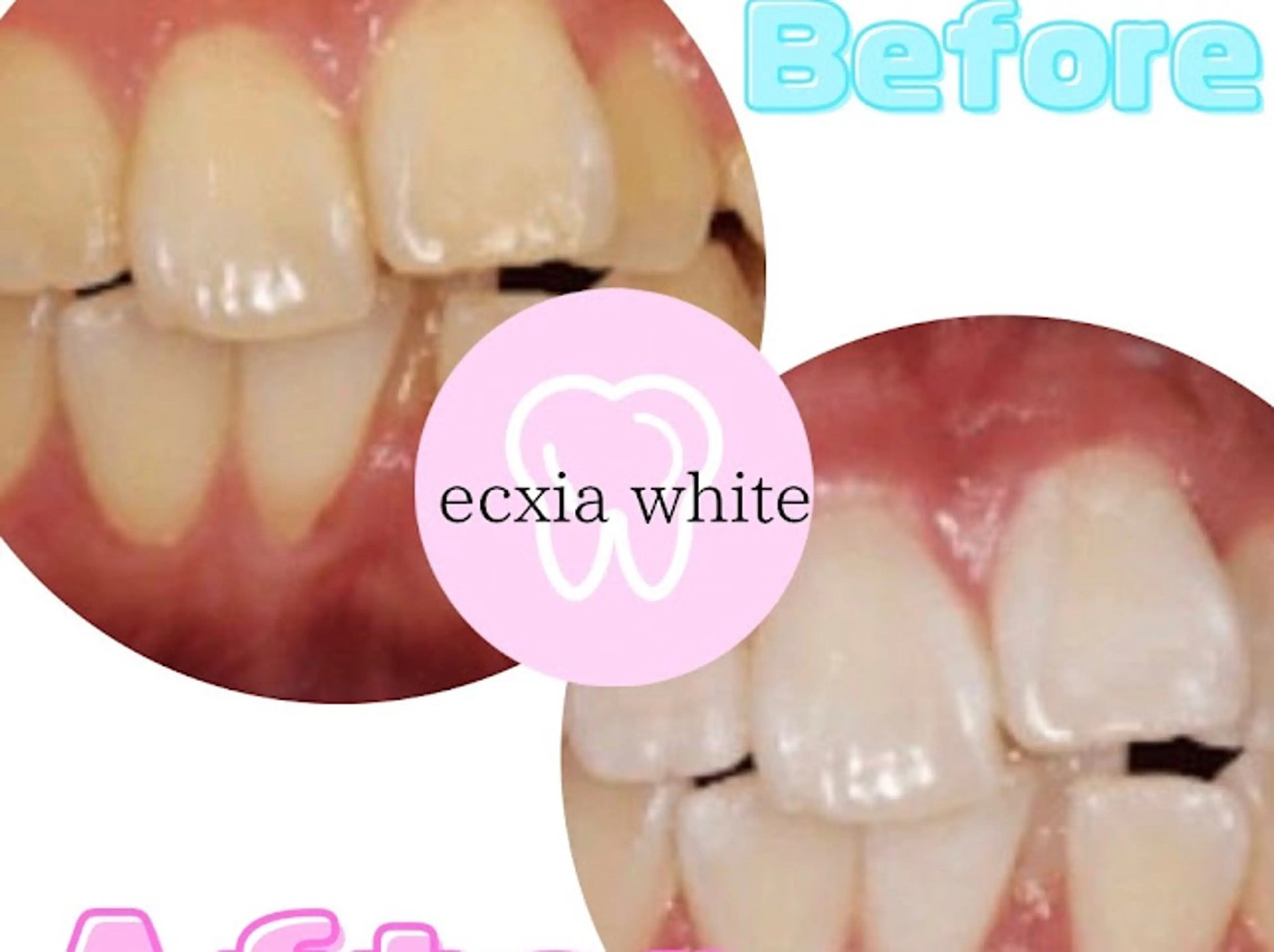 エステ セルフホワイトニング エクシア浜松店のエステ・リラクイメージ