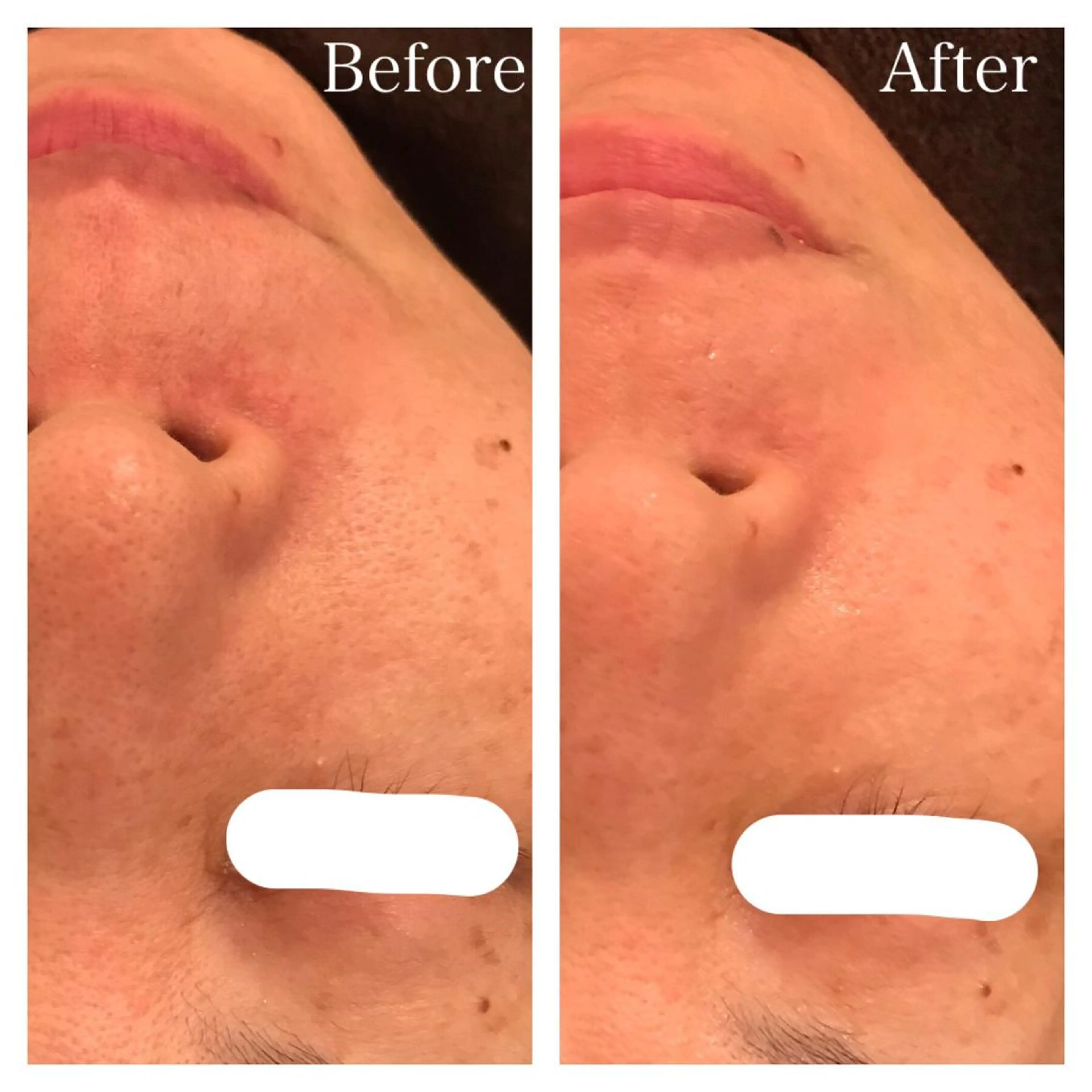 ロング ヘアアレンジ ネイル マツエク・マツパ ニキビ跡専門サロン Ａｉｎａのエステ・リラクイメージ